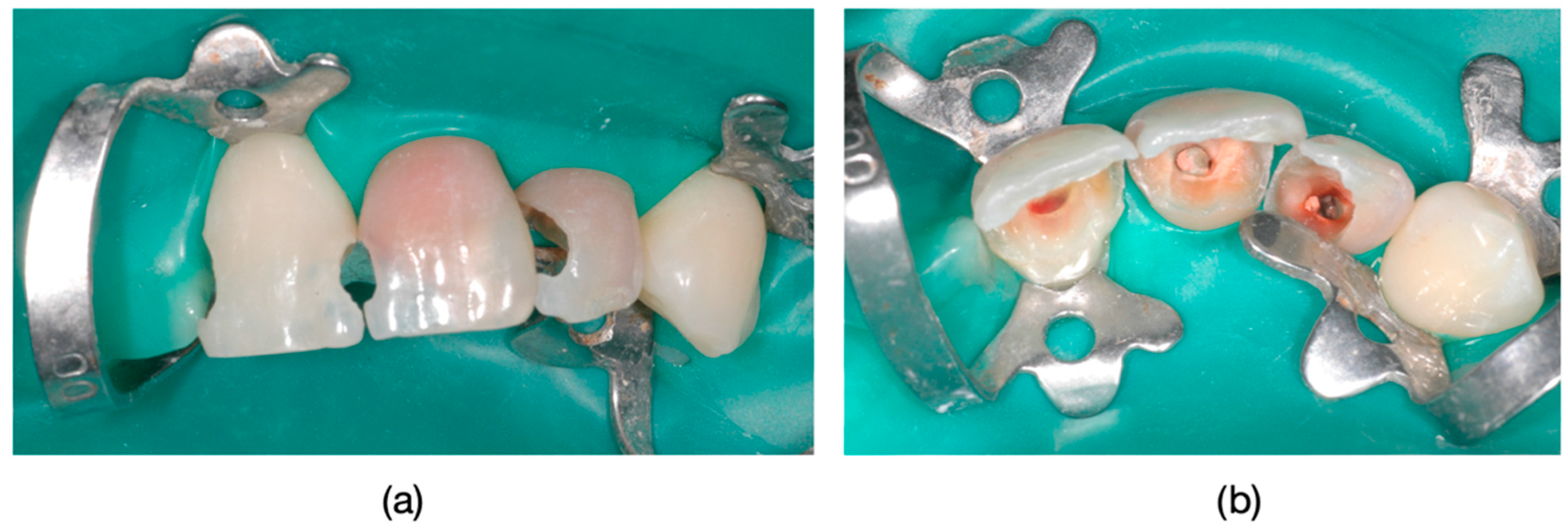 Dentistry 13 00044 g003