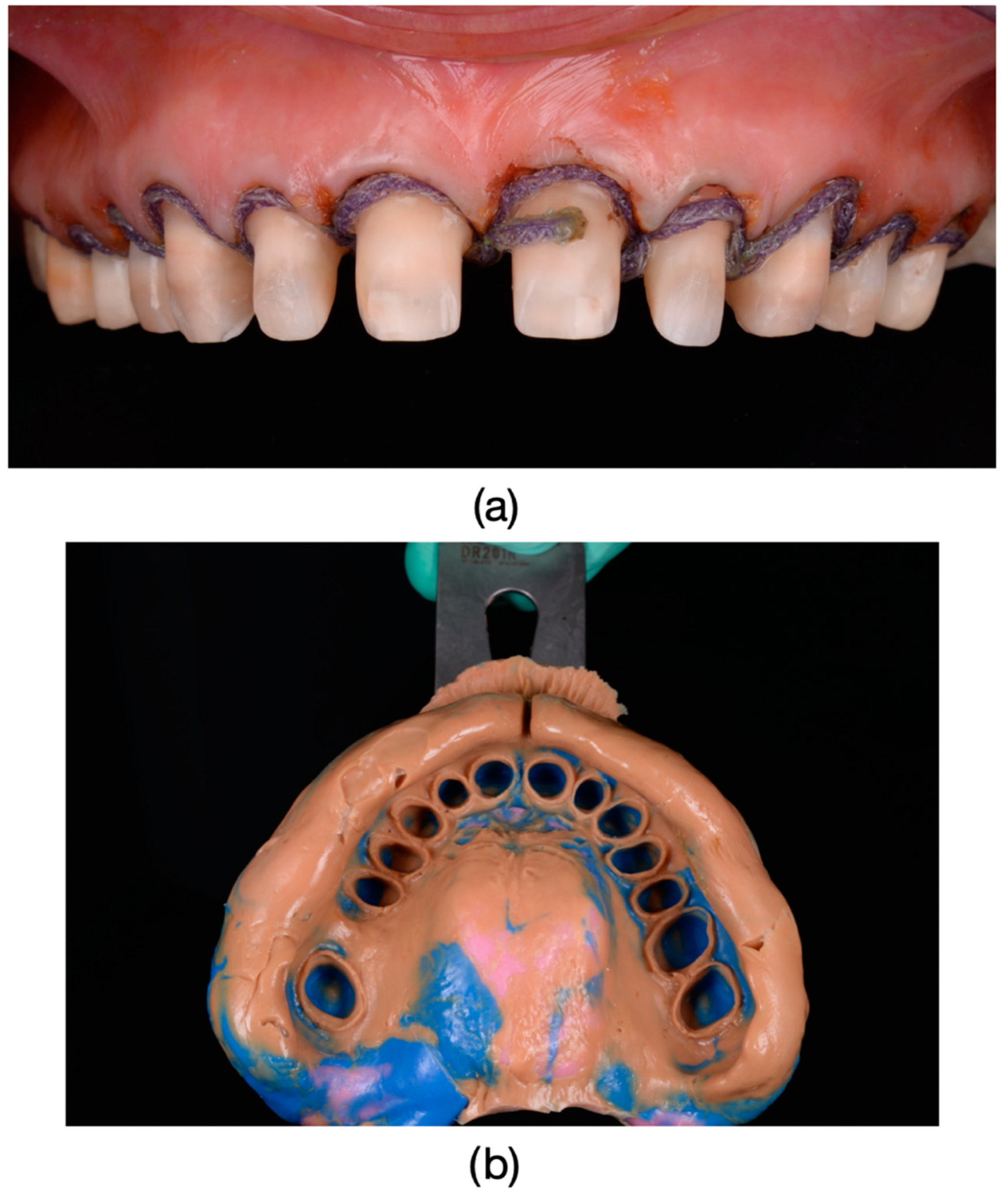 Dentistry 13 00044 g005