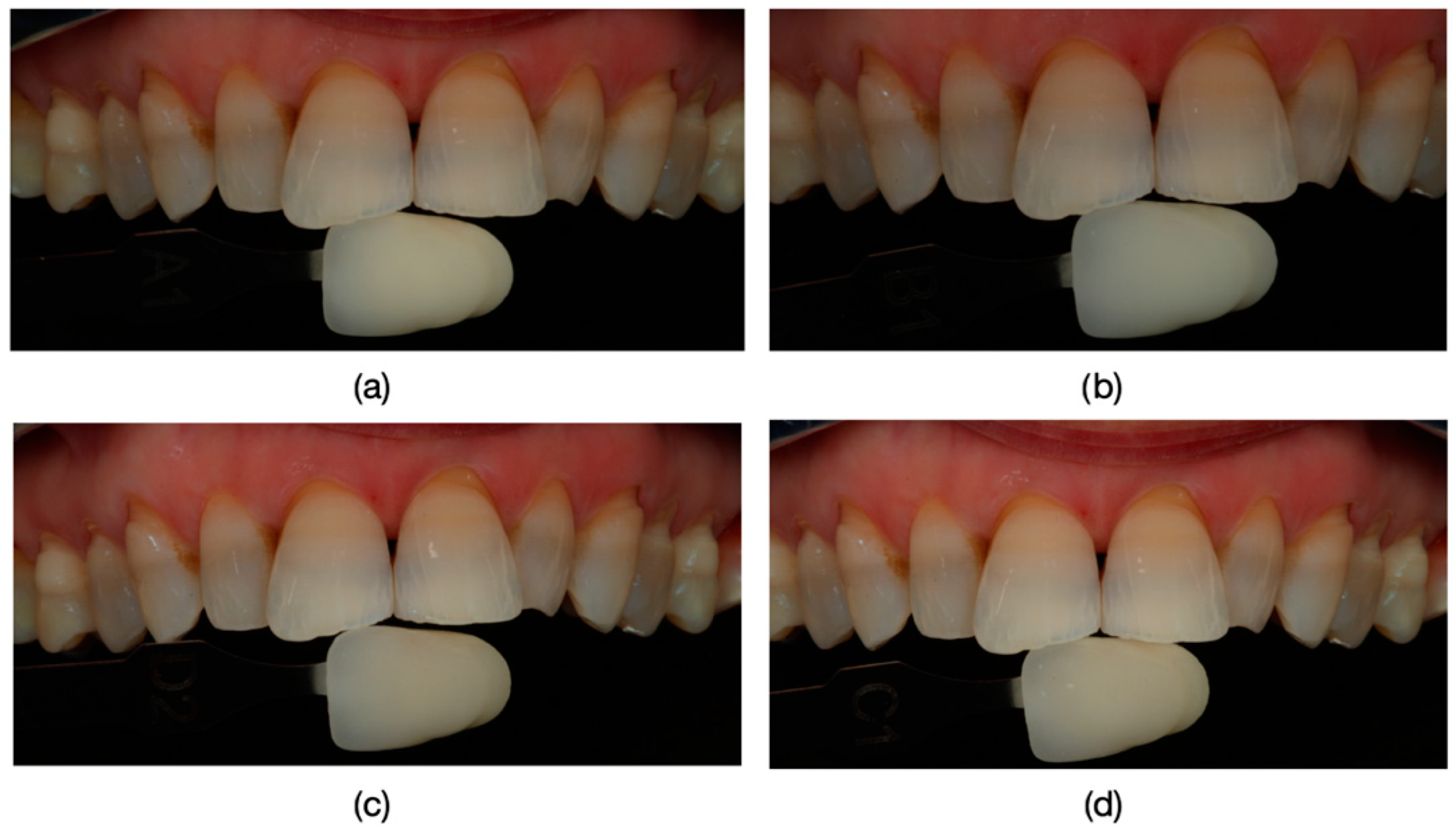 Dentistry 13 00044 g006