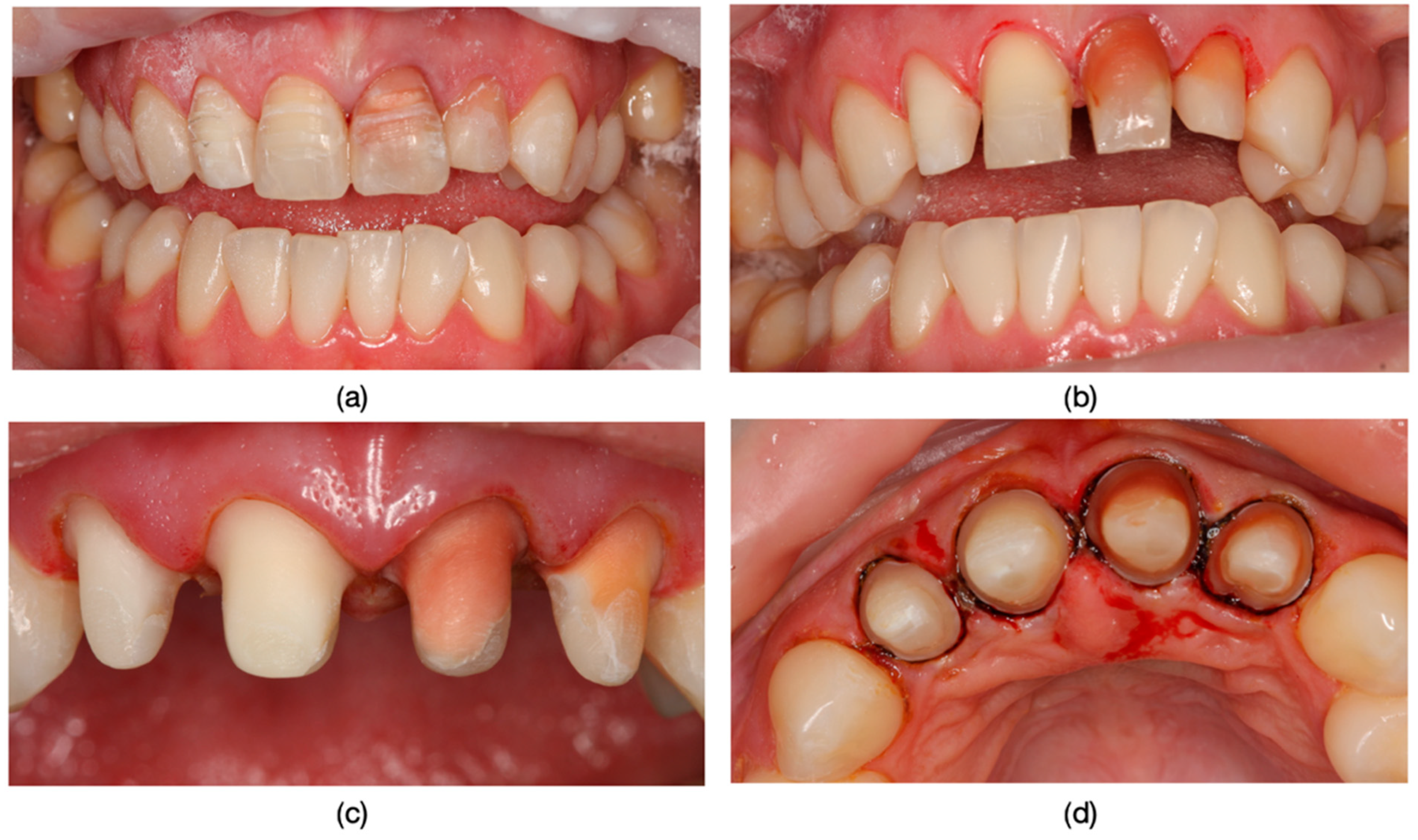 Dentistry 13 00044 g008