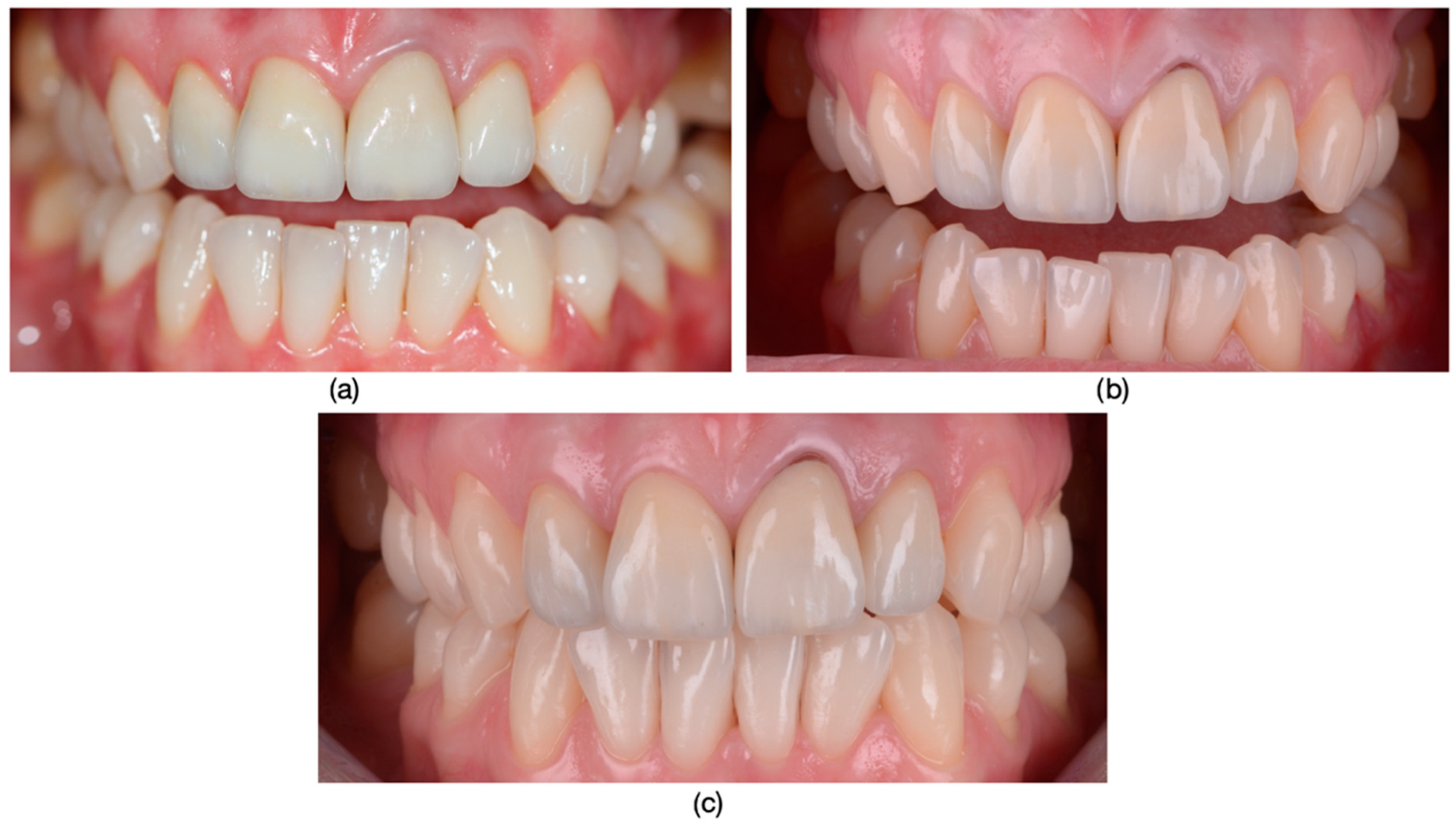 Dentistry 13 00044 g009