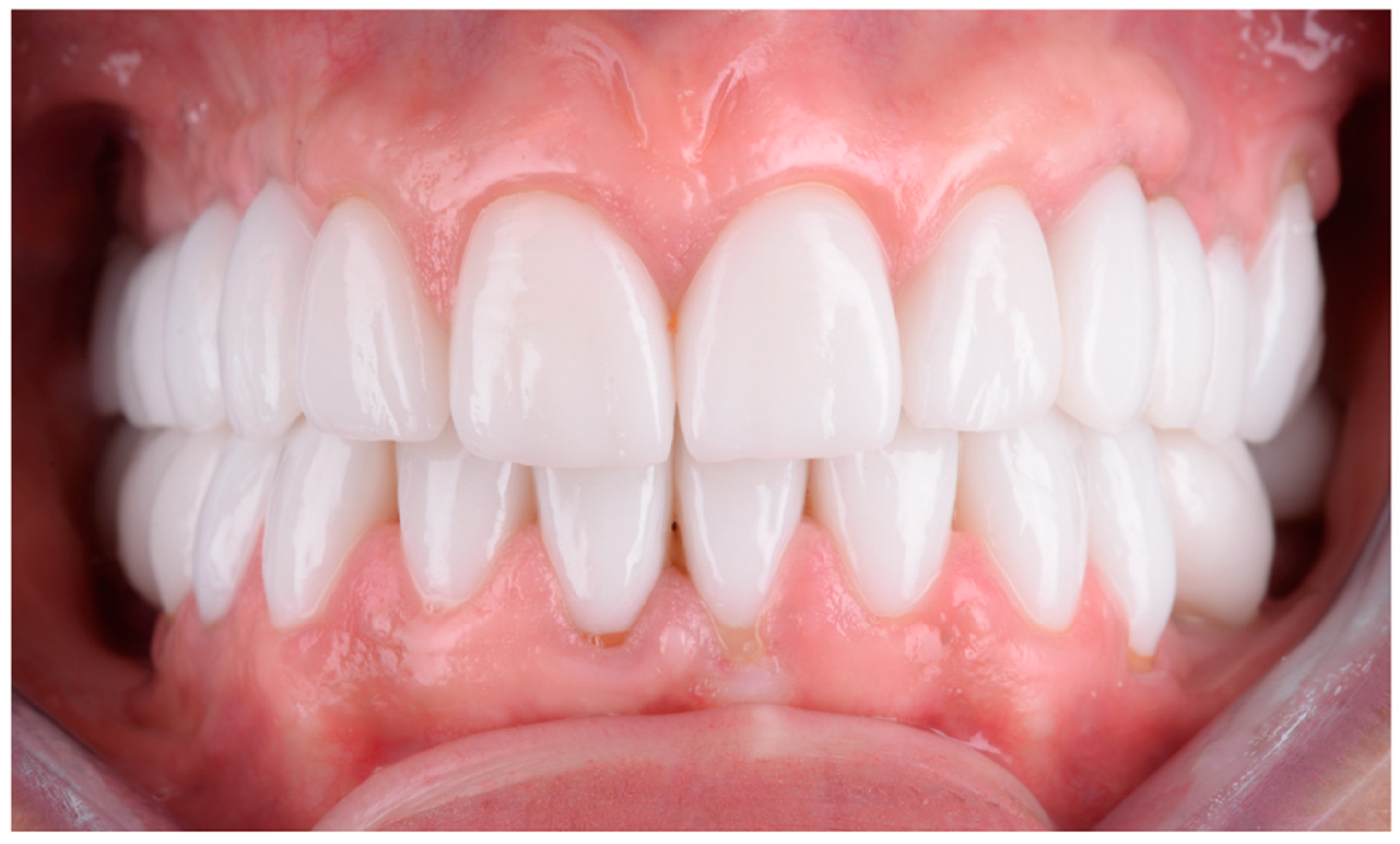 Dentistry 13 00044 g014