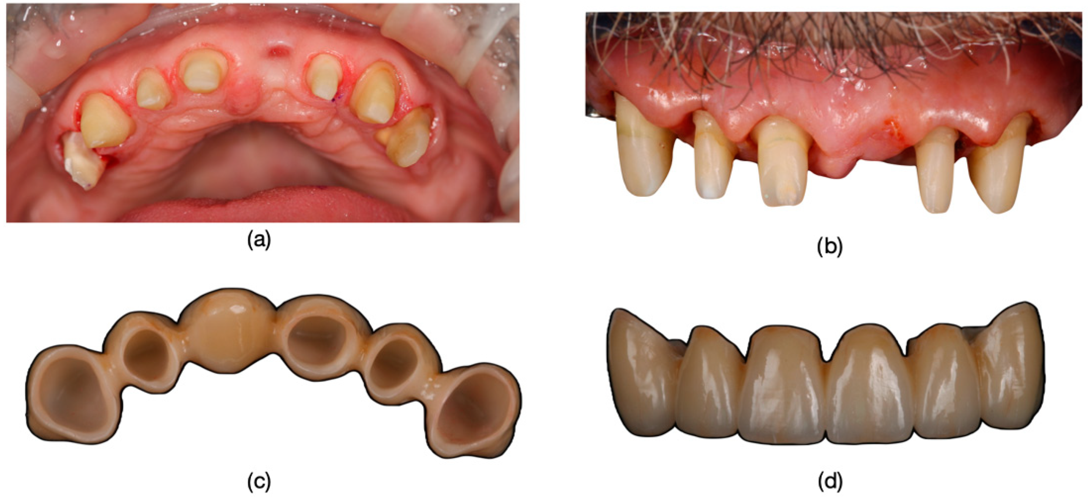 Dentistry 13 00044 g017