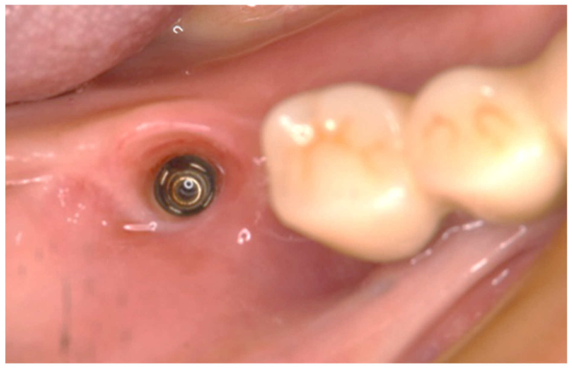 Dentistry 13 00053 g003