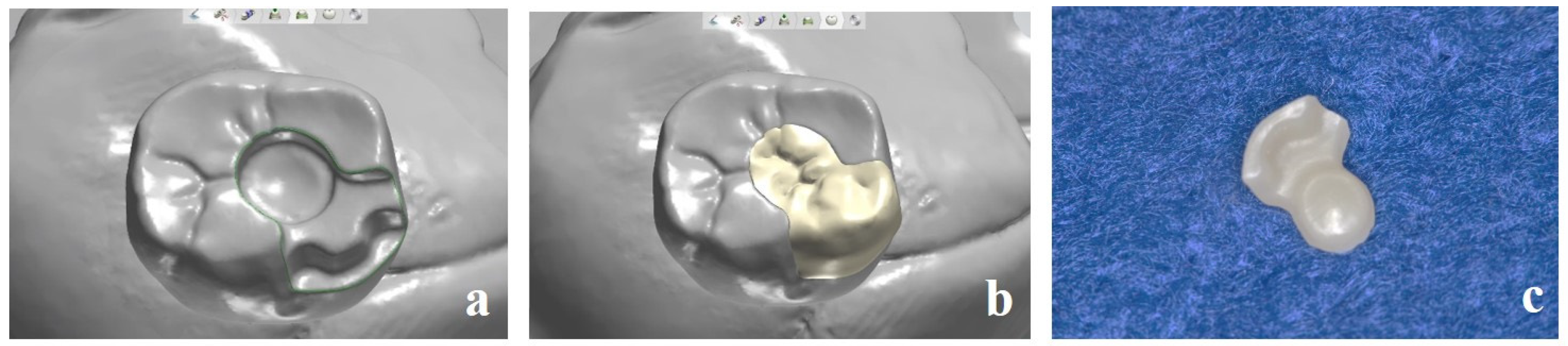 Dentistry 13 00053 g005