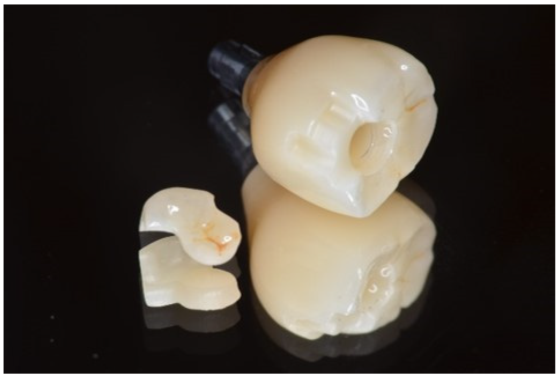 Dentistry 13 00053 g006