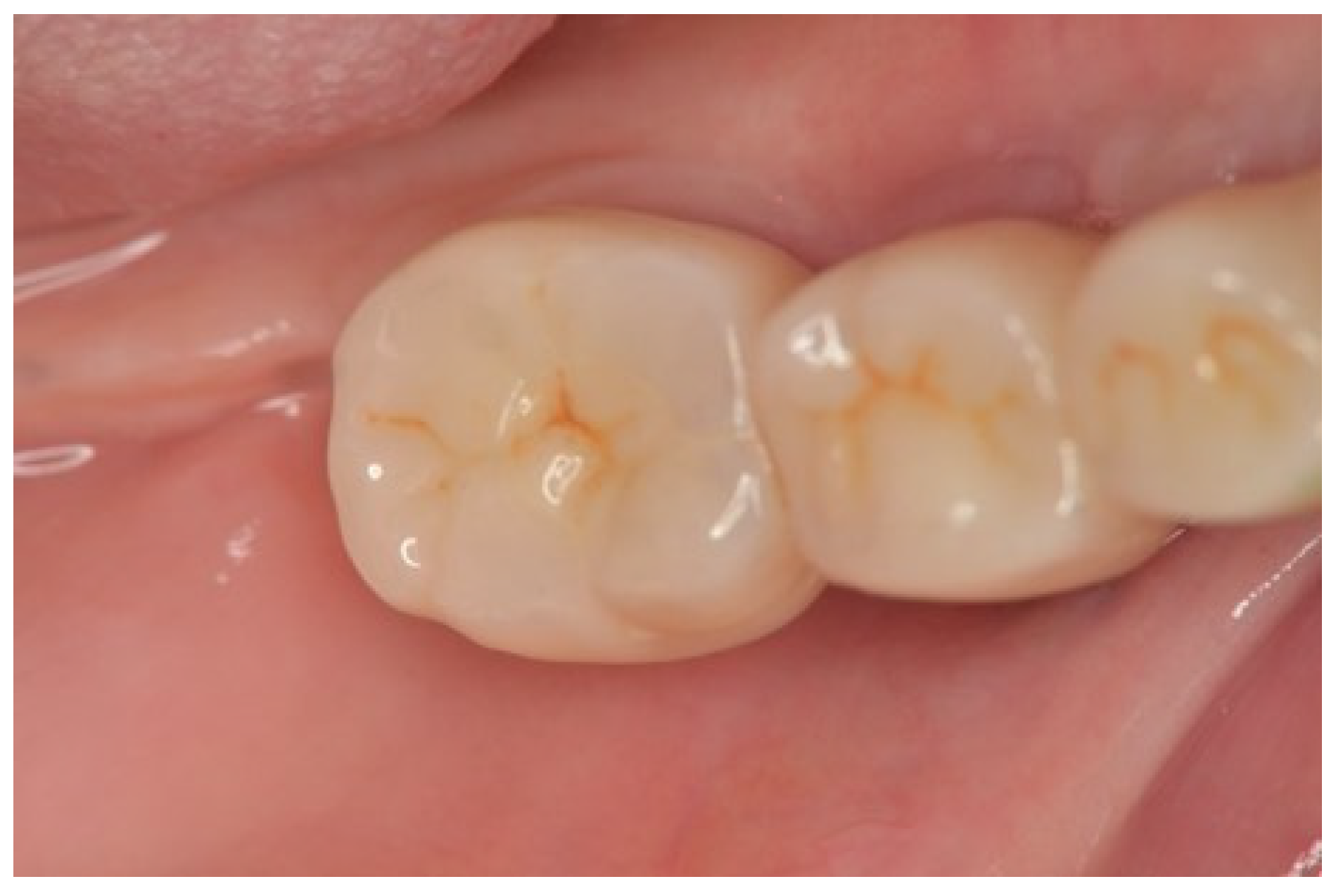 Dentistry 13 00053 g007