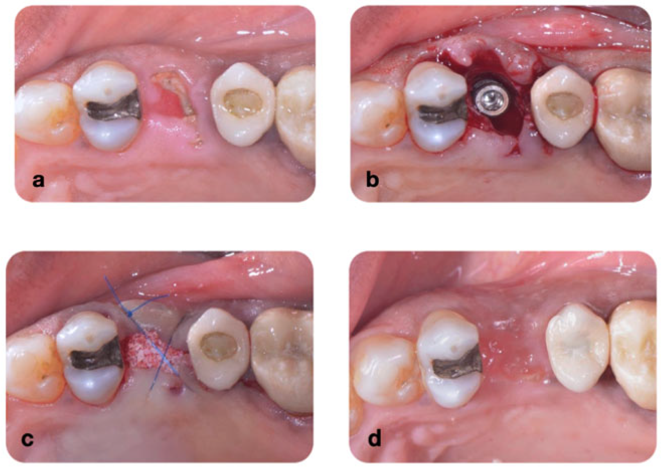 Dentistry 13 00058 g002