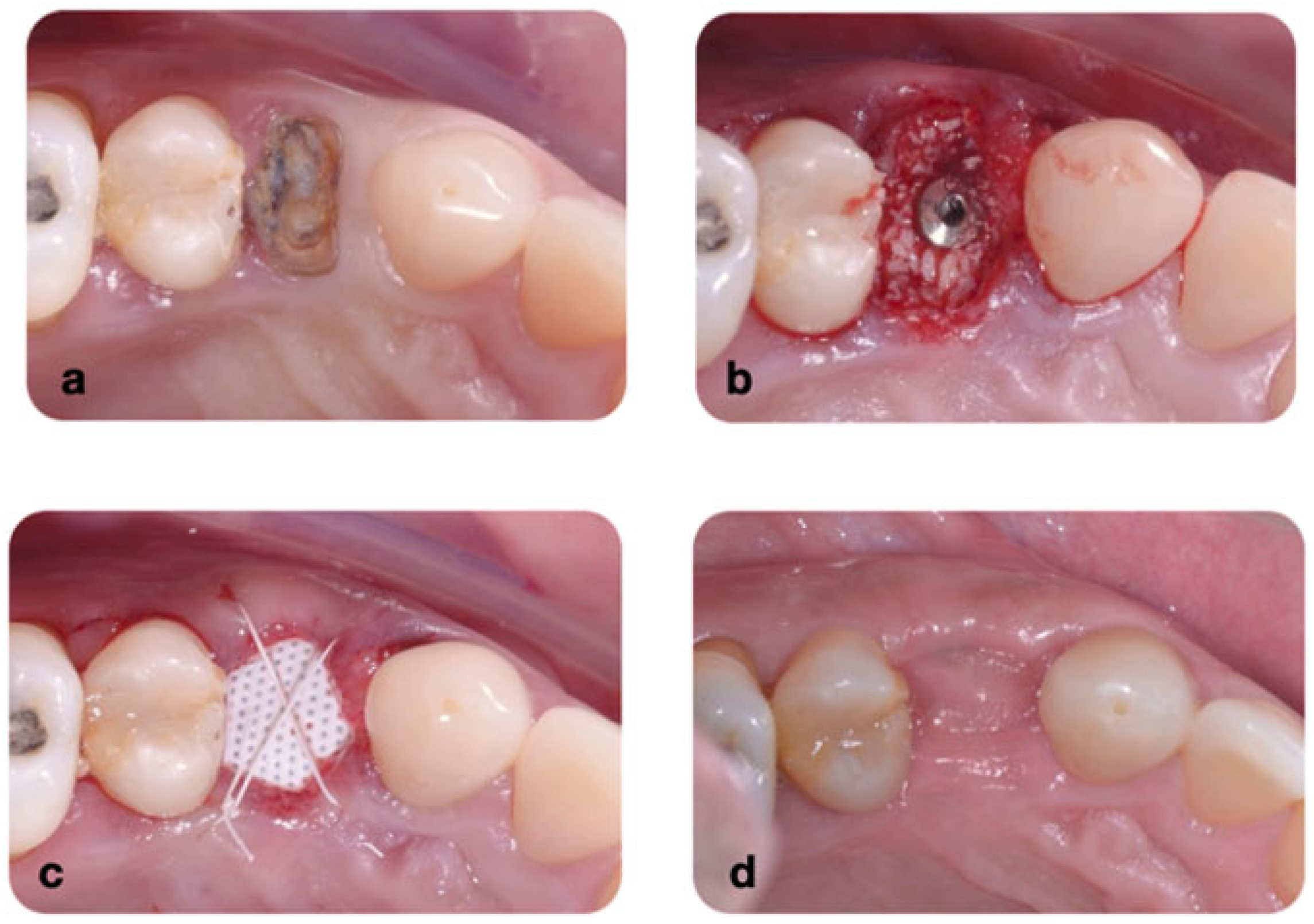Dentistry 13 00058 g003