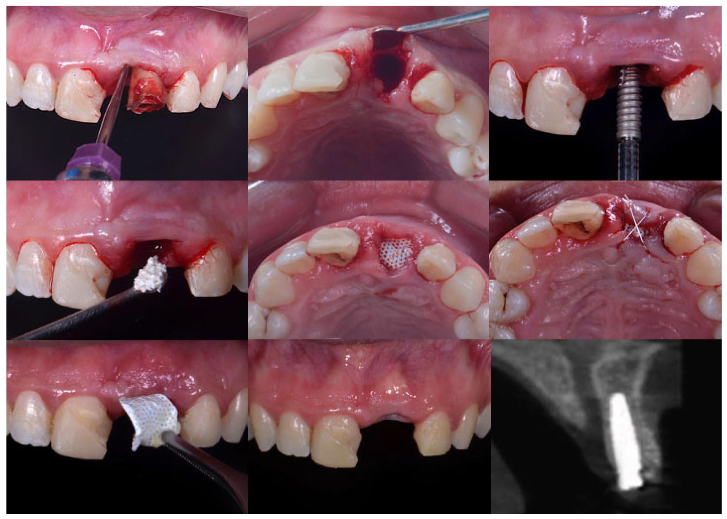 Dentistry 13 00058 g004