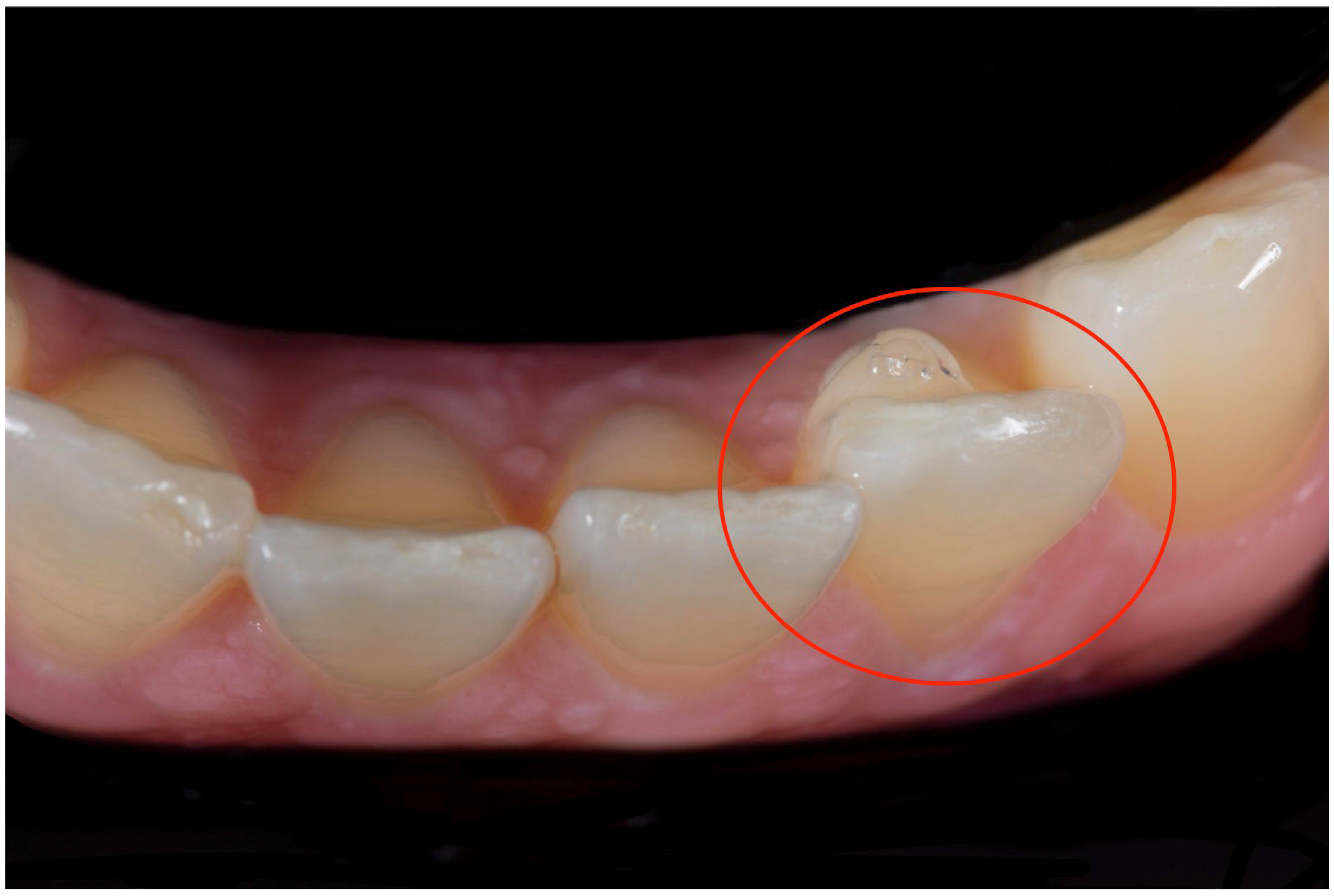 Dentistry 13 00067 g001