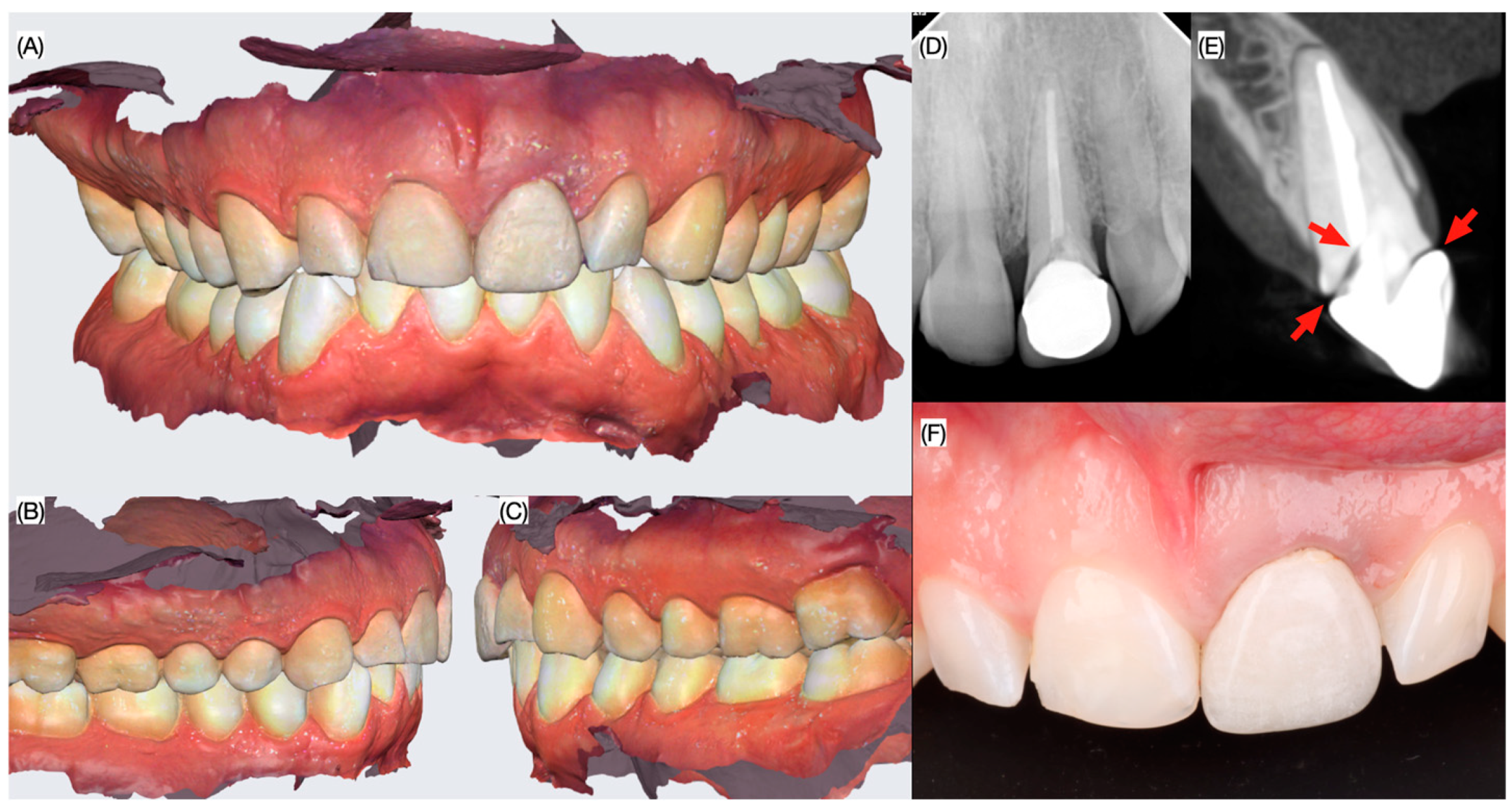 Dentistry 13 00073 g001