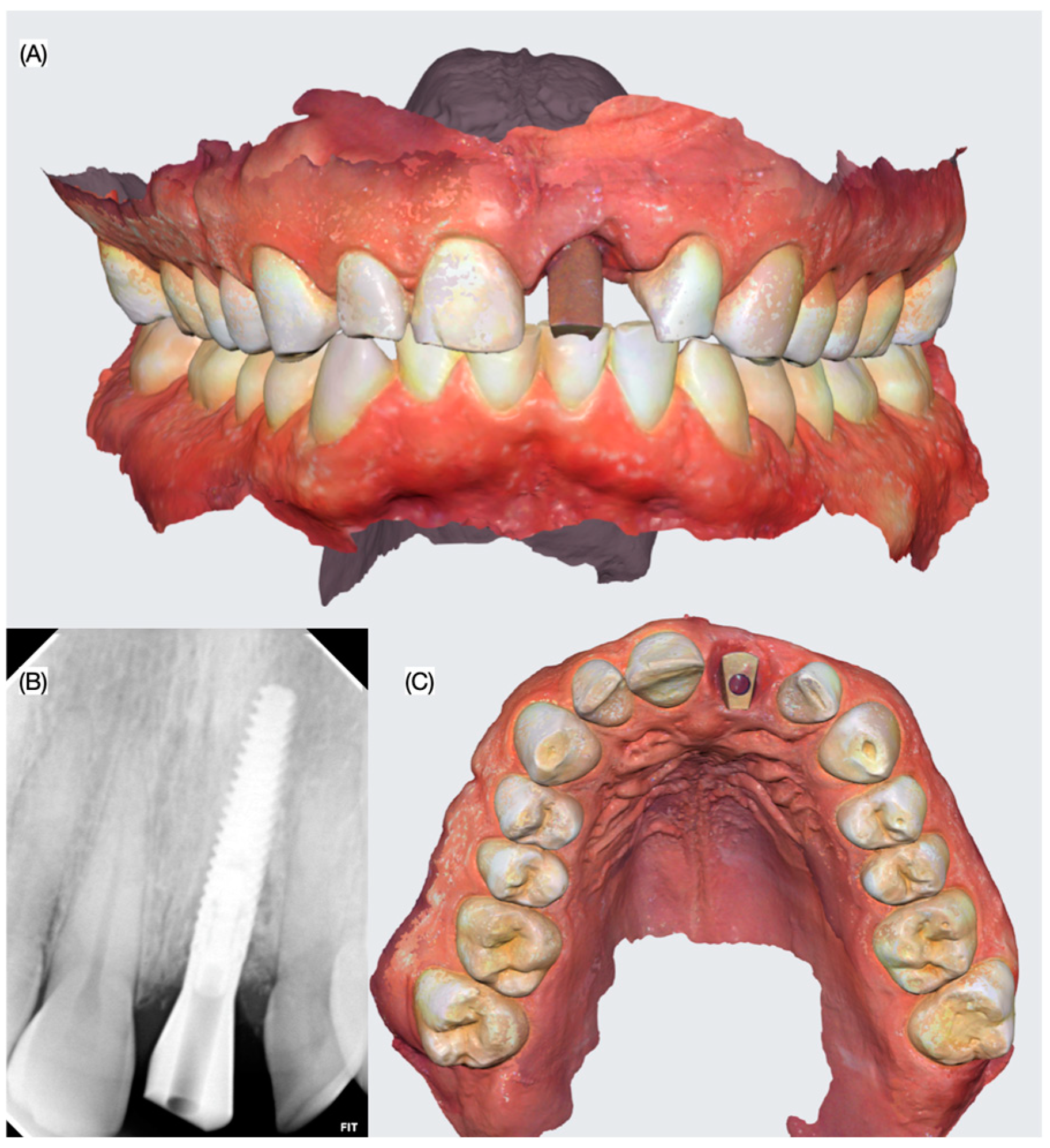 Dentistry 13 00073 g008
