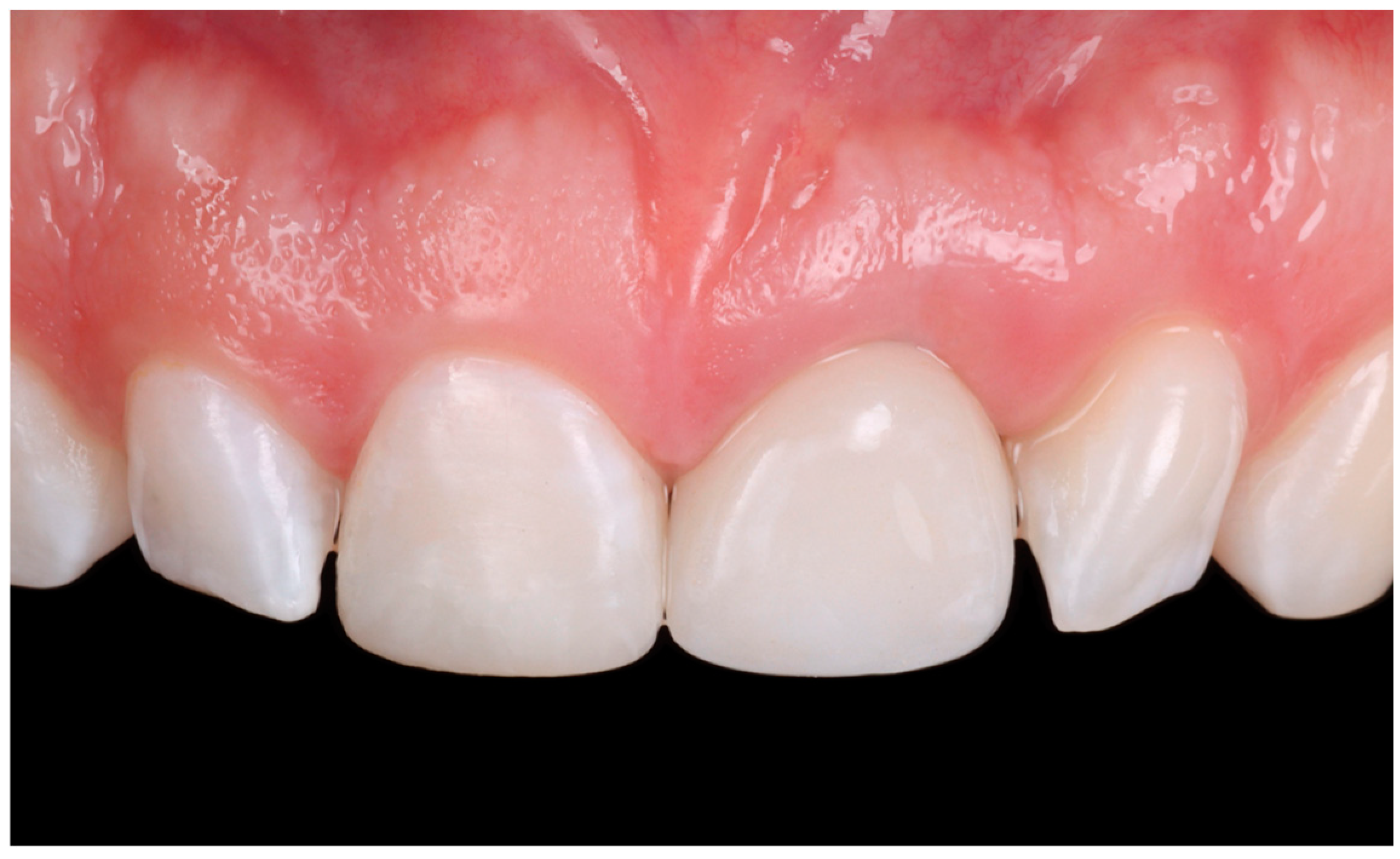 Dentistry 13 00073 g011