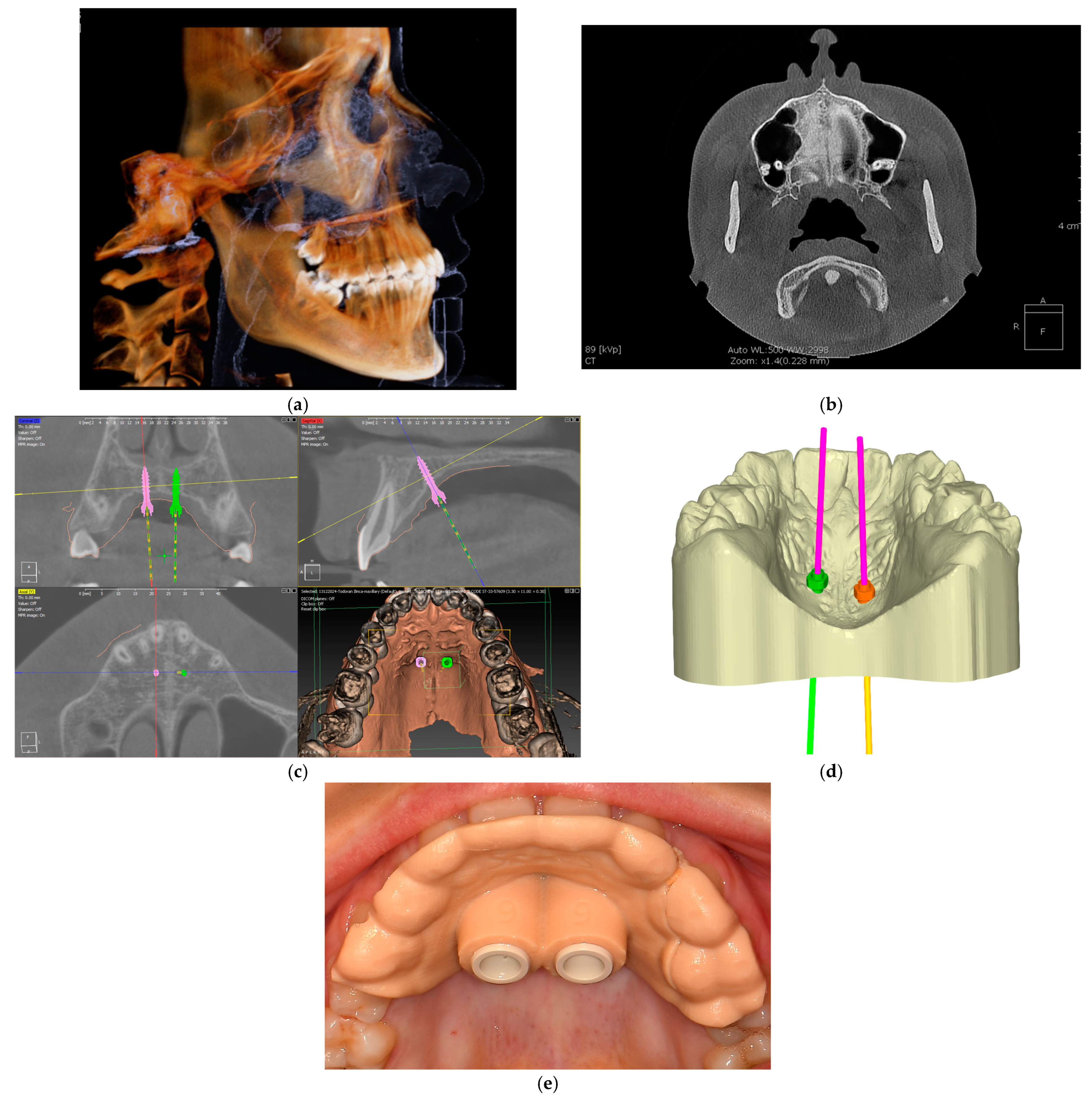 Dentistry 13 00074 g001