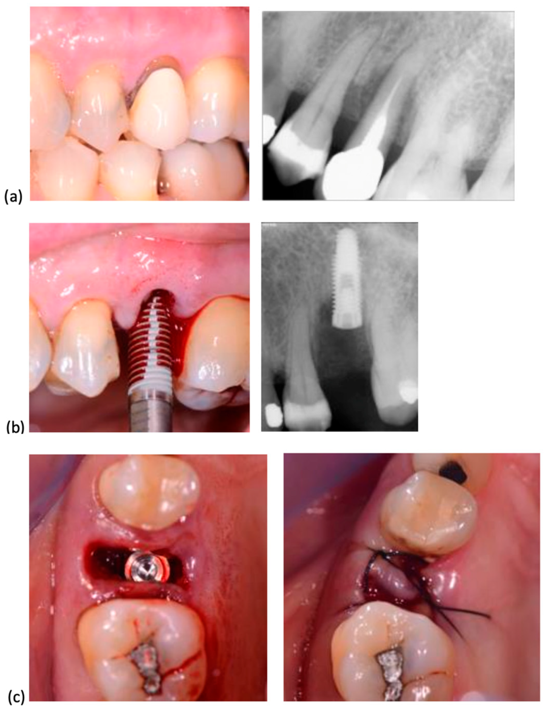 Dentistry 13 00078 g002