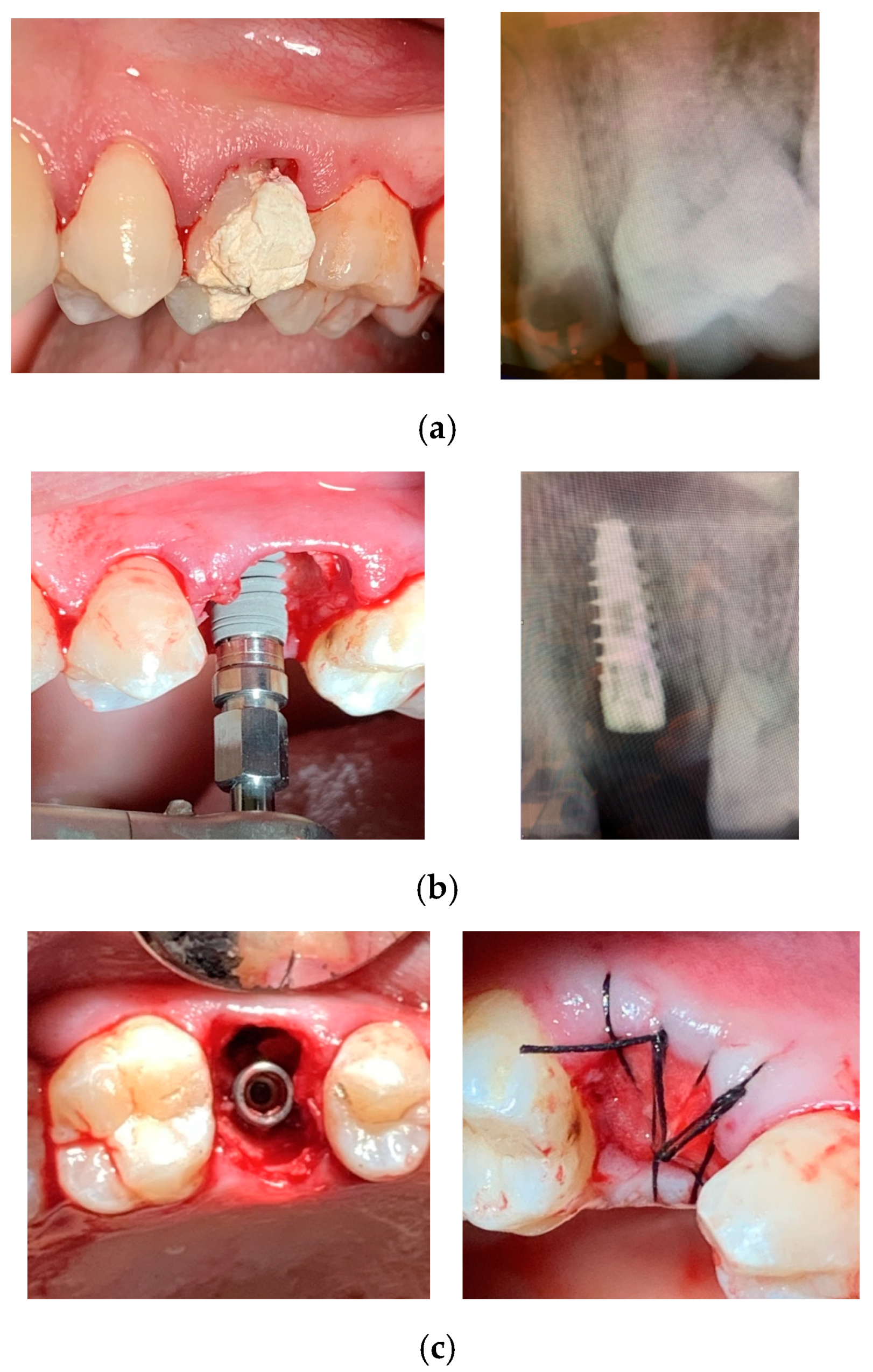 Dentistry 13 00078 g003