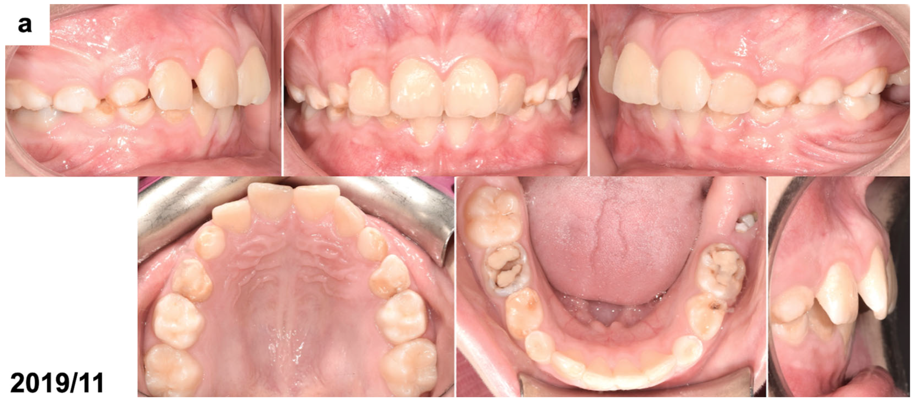 Dentistry 13 00082 g001a