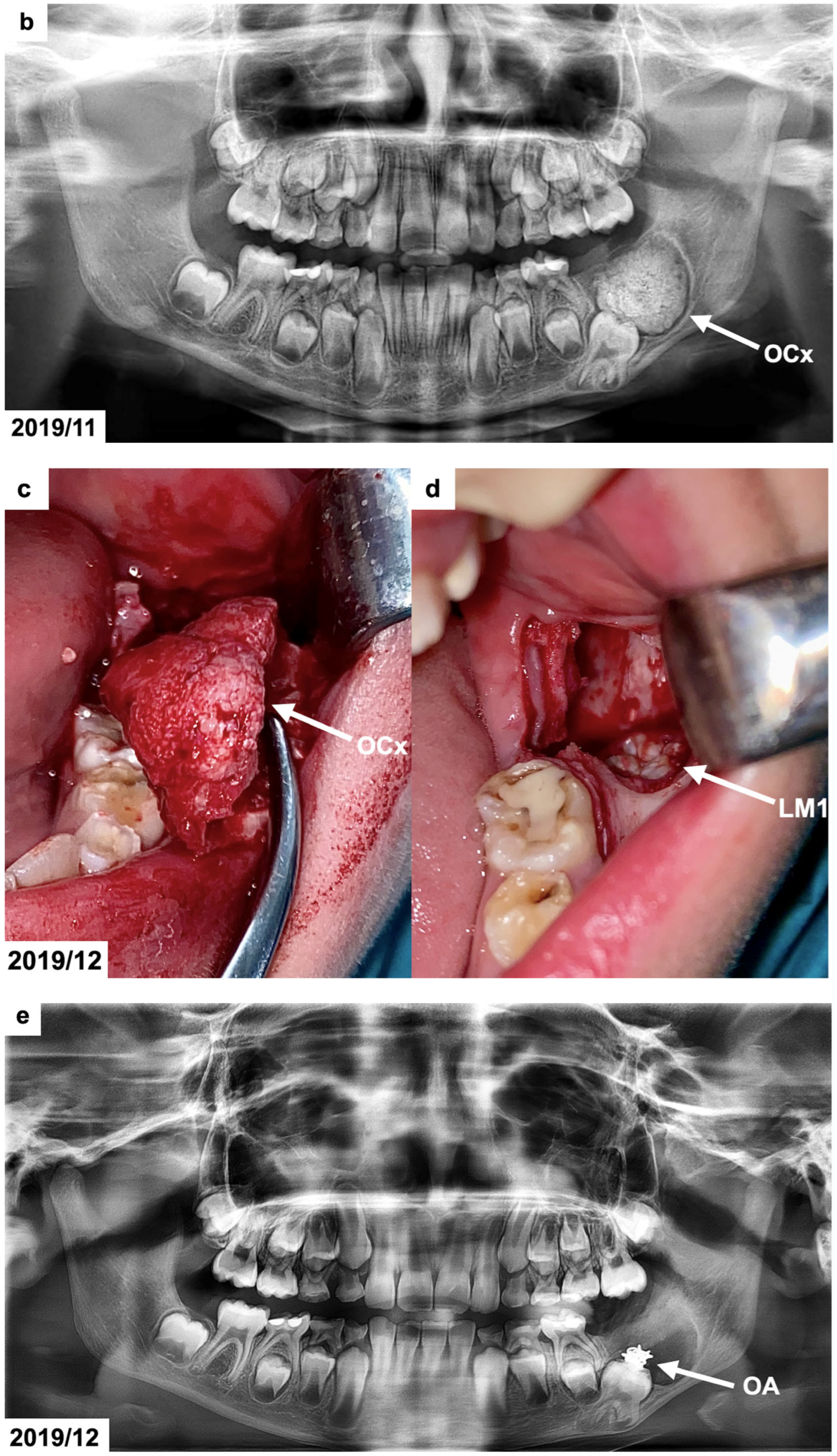 Dentistry 13 00082 g001b