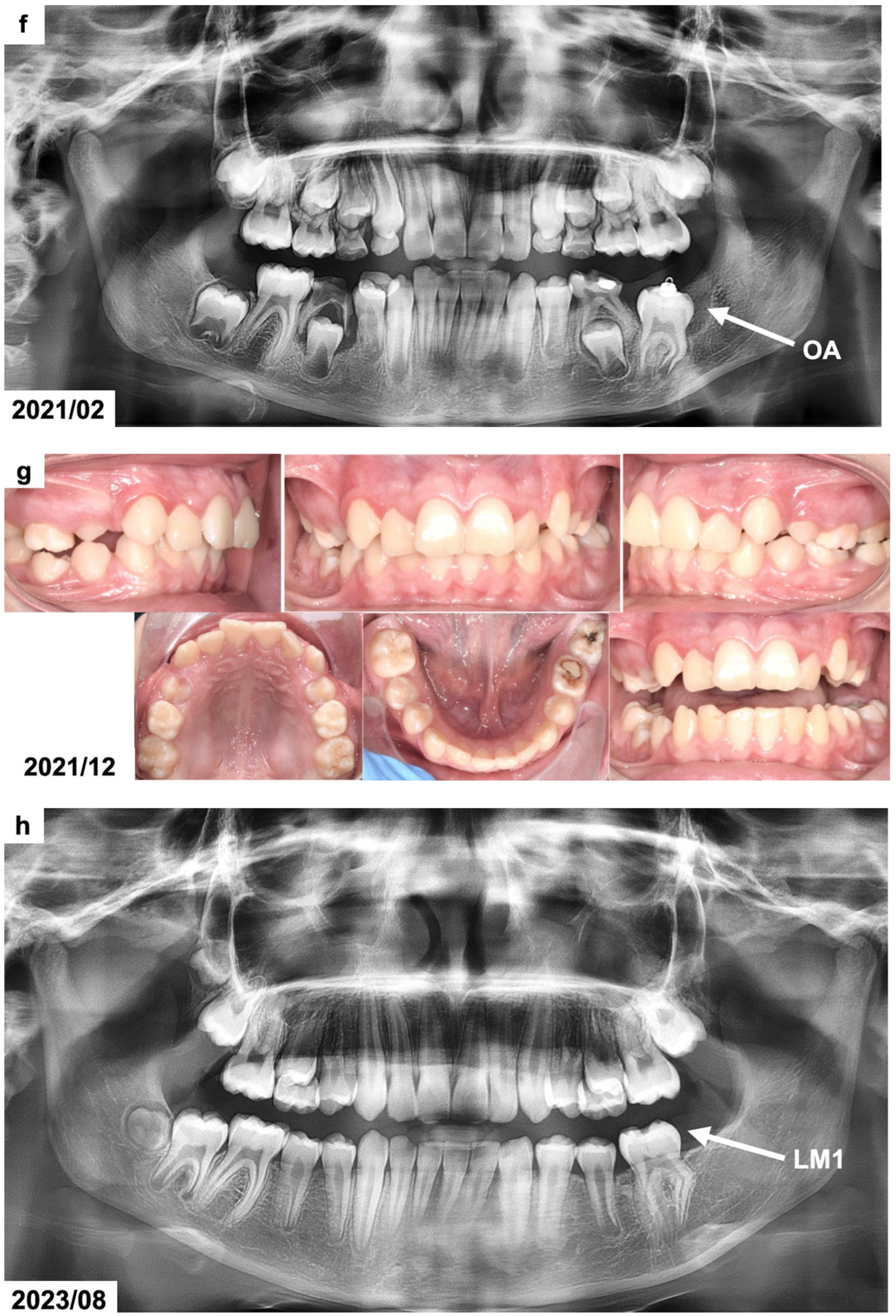 Dentistry 13 00082 g001c