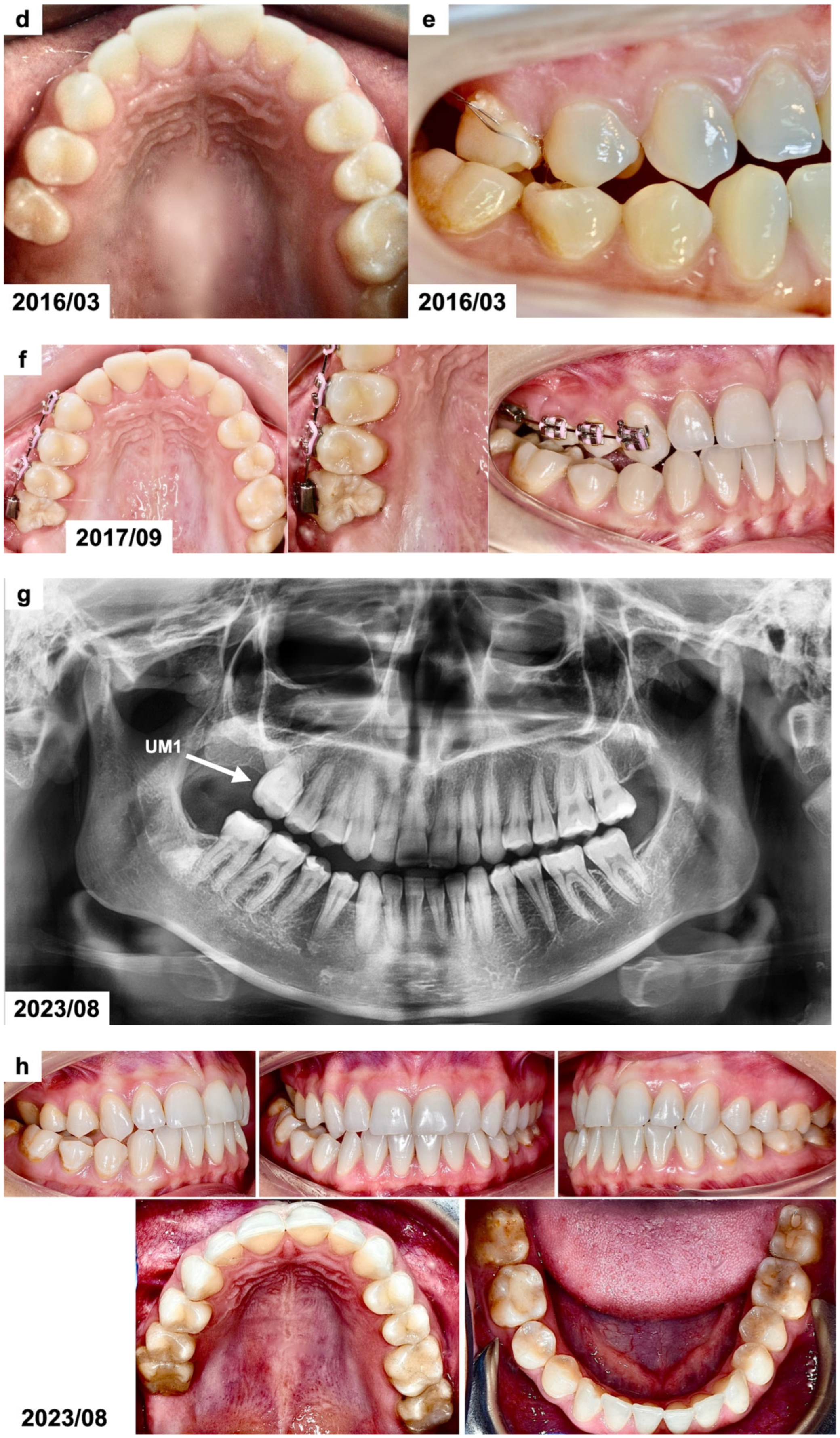 Dentistry 13 00082 g002b