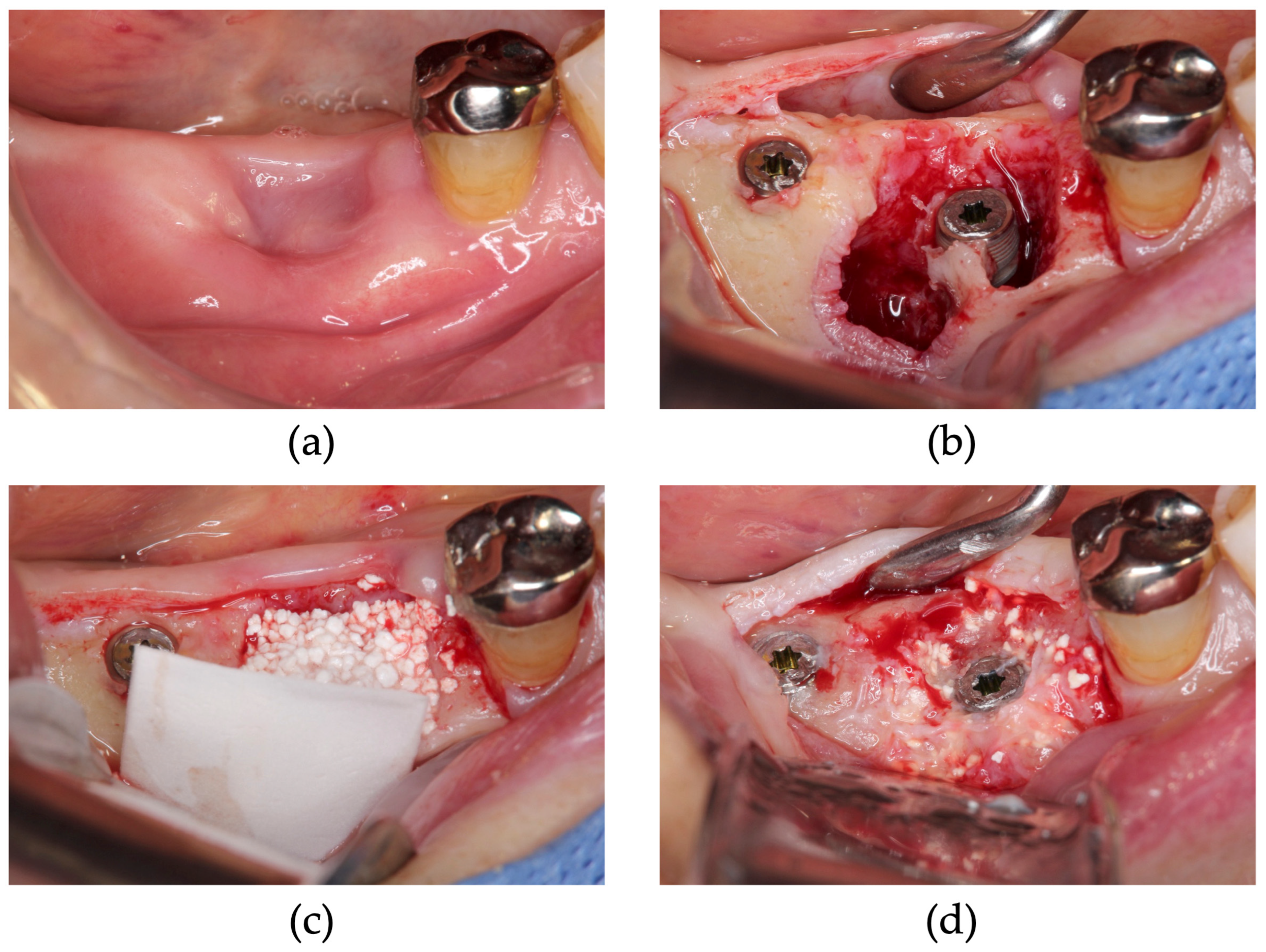 Dentistry 13 00085 g008