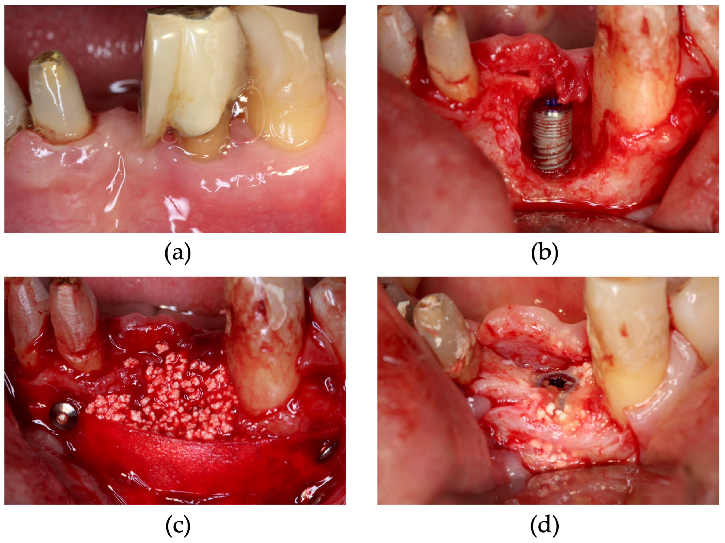 Dentistry 13 00085 g009