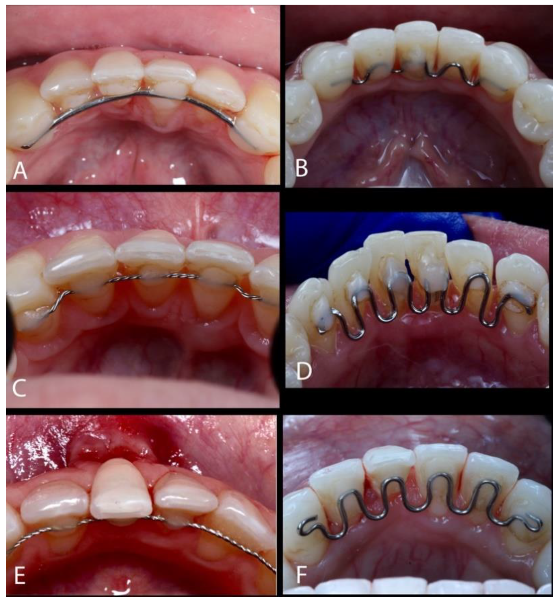 Dentistry 13 00093 g001
