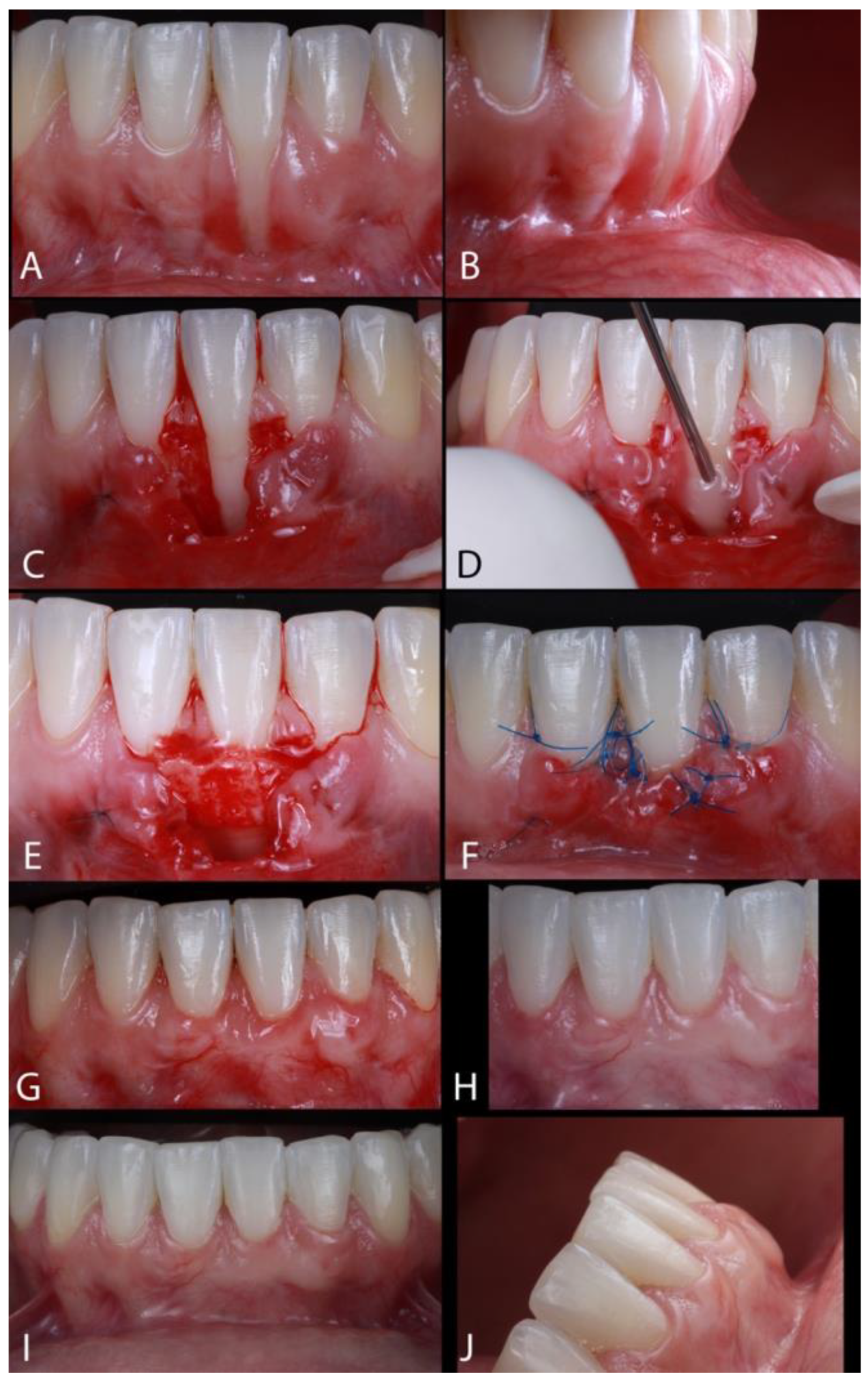 Dentistry 13 00093 g002