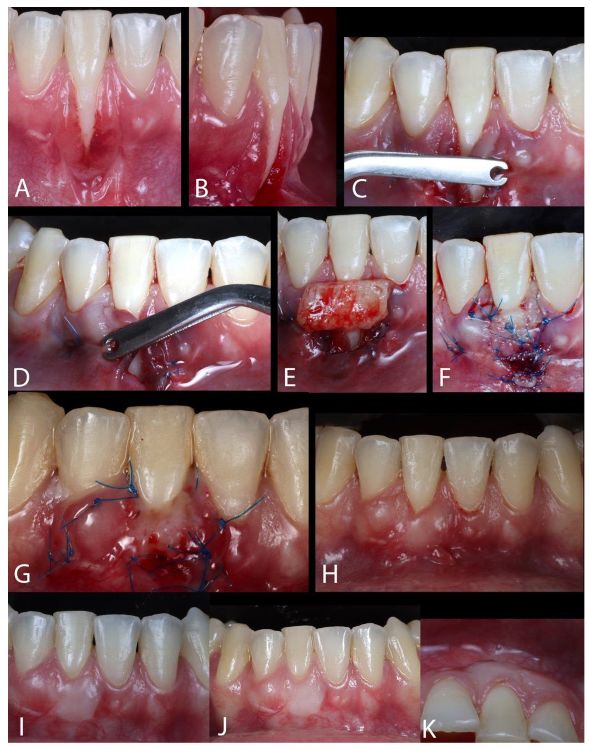 Dentistry 13 00093 g003
