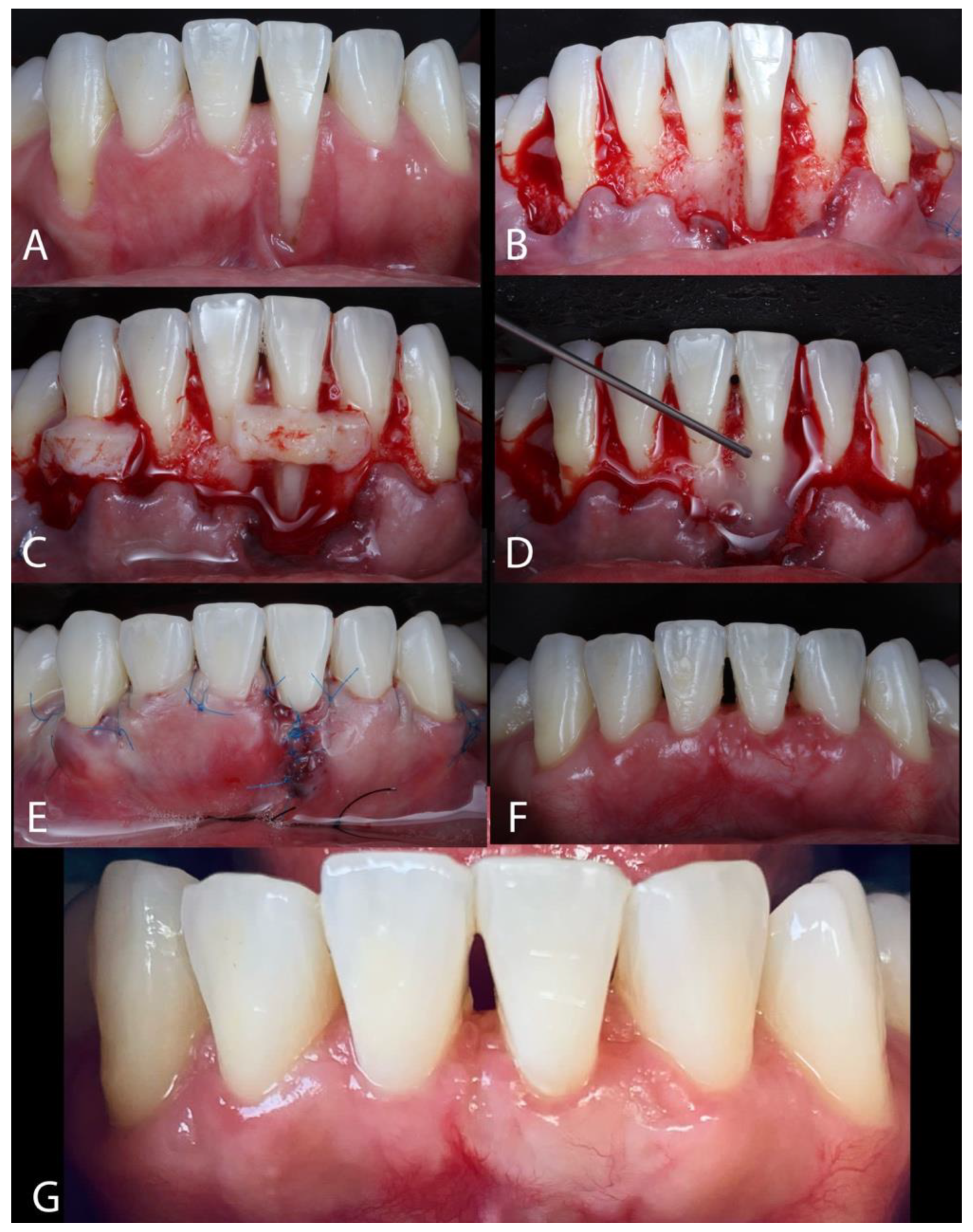 Dentistry 13 00093 g004