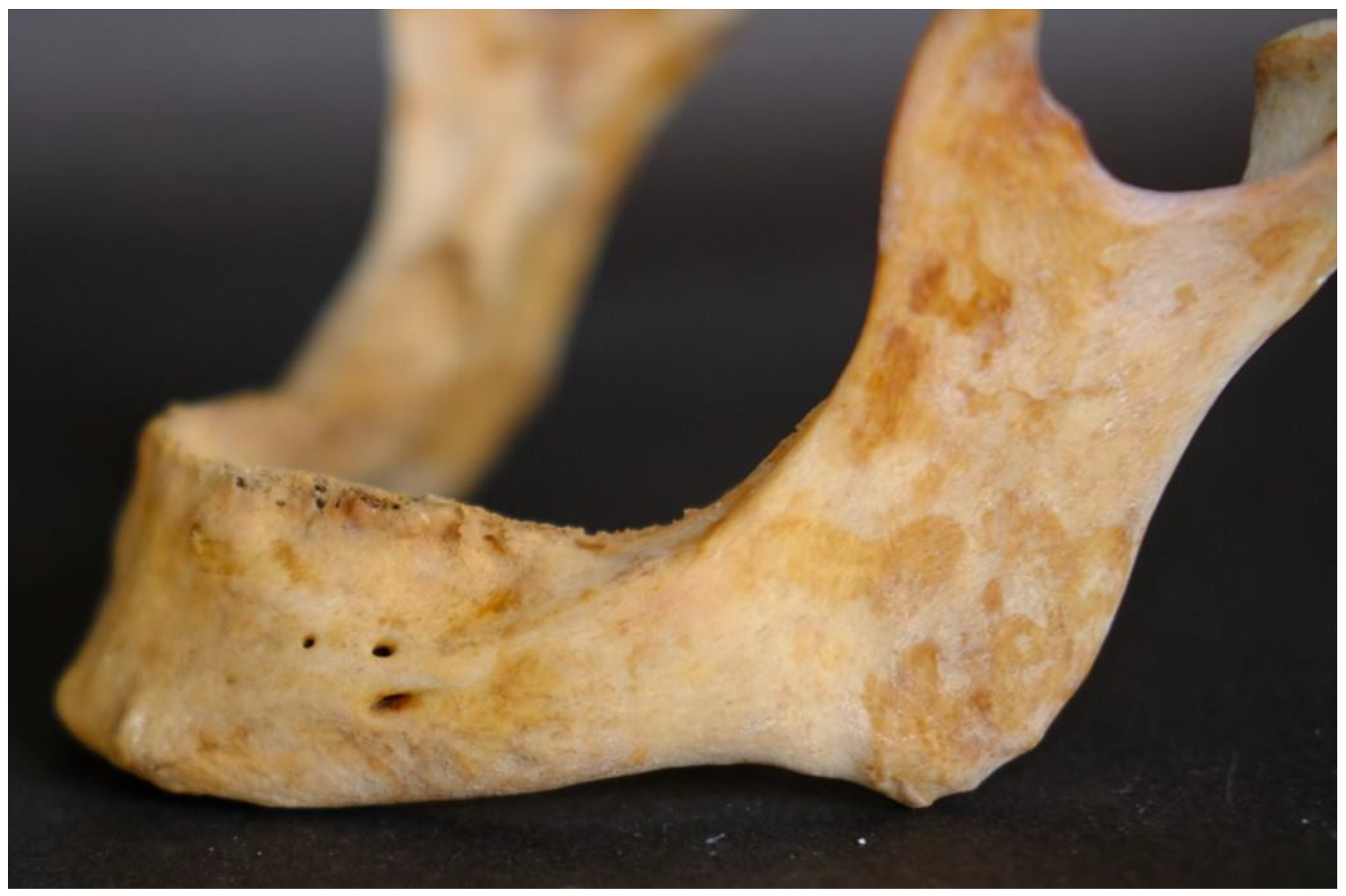 Dentistry 13 00094 g003