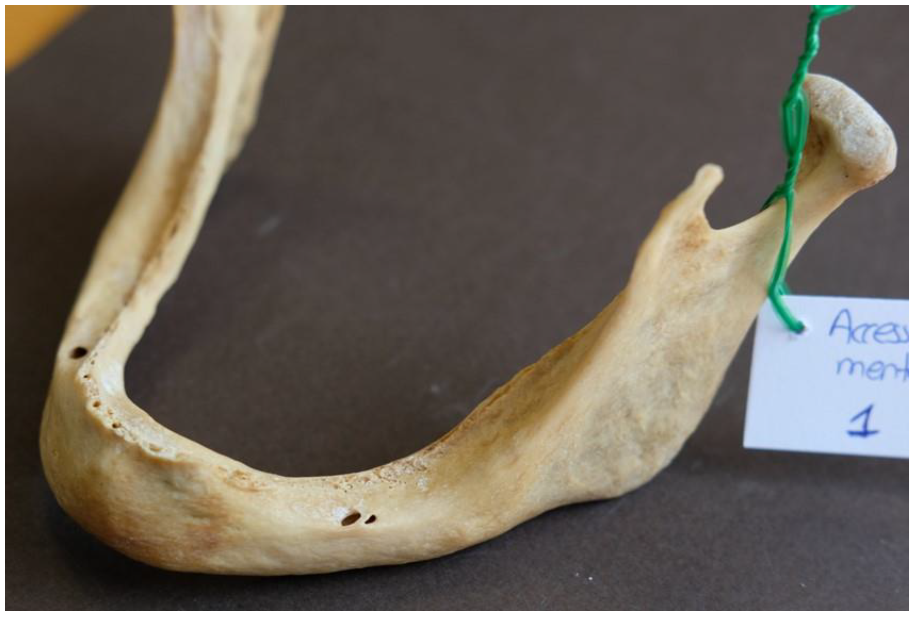 Dentistry 13 00094 g004