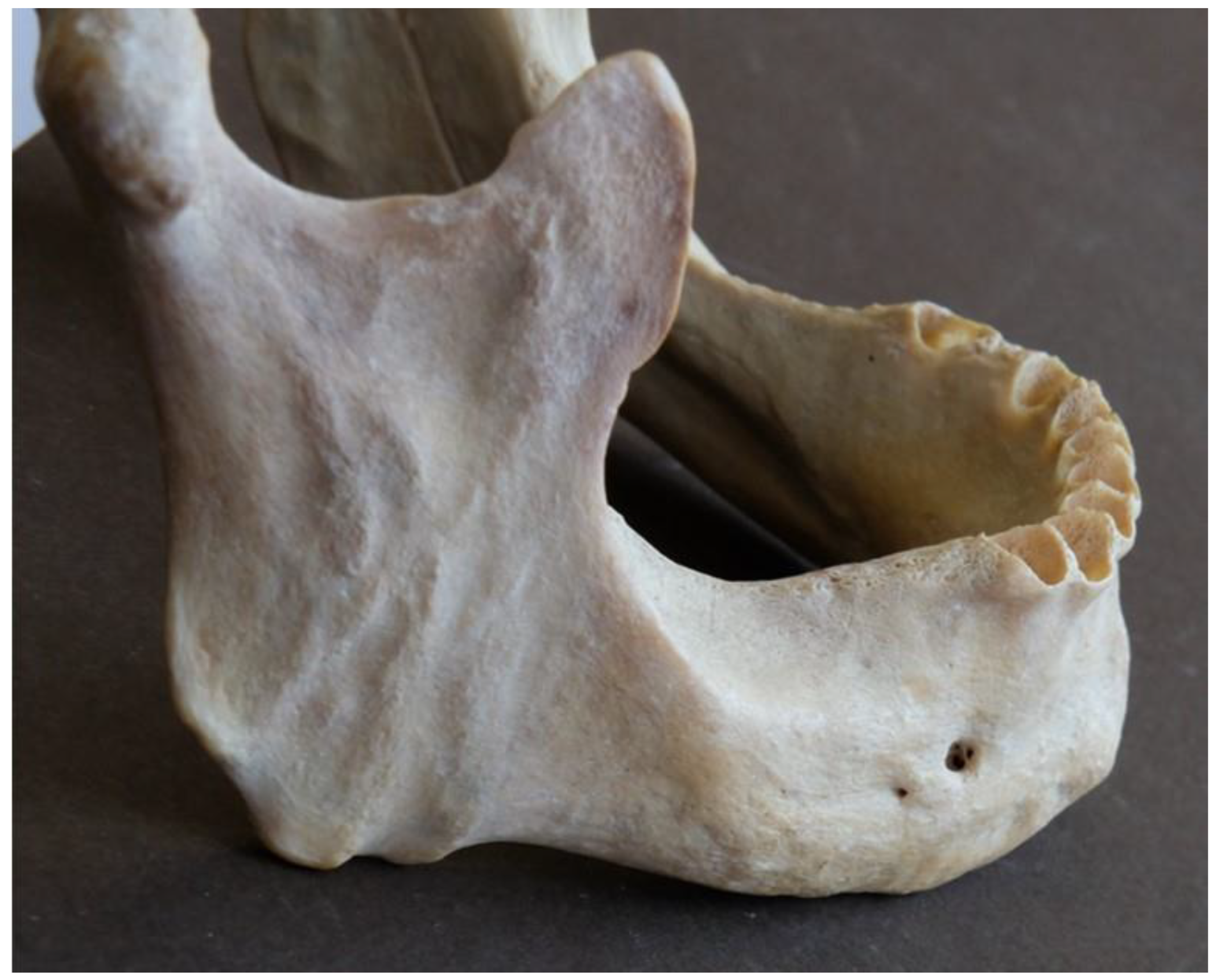 Dentistry 13 00094 g005