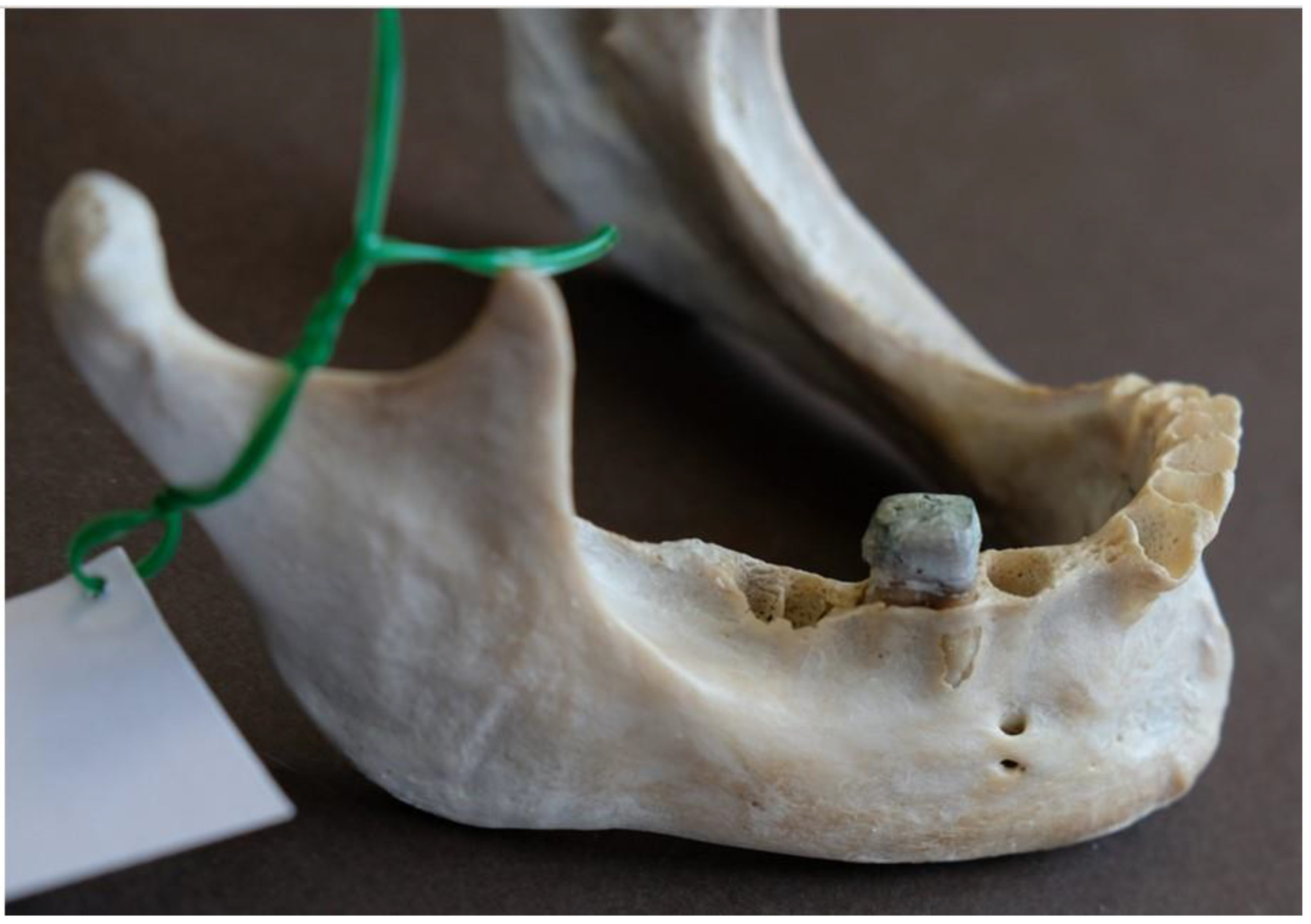 Dentistry 13 00094 g006