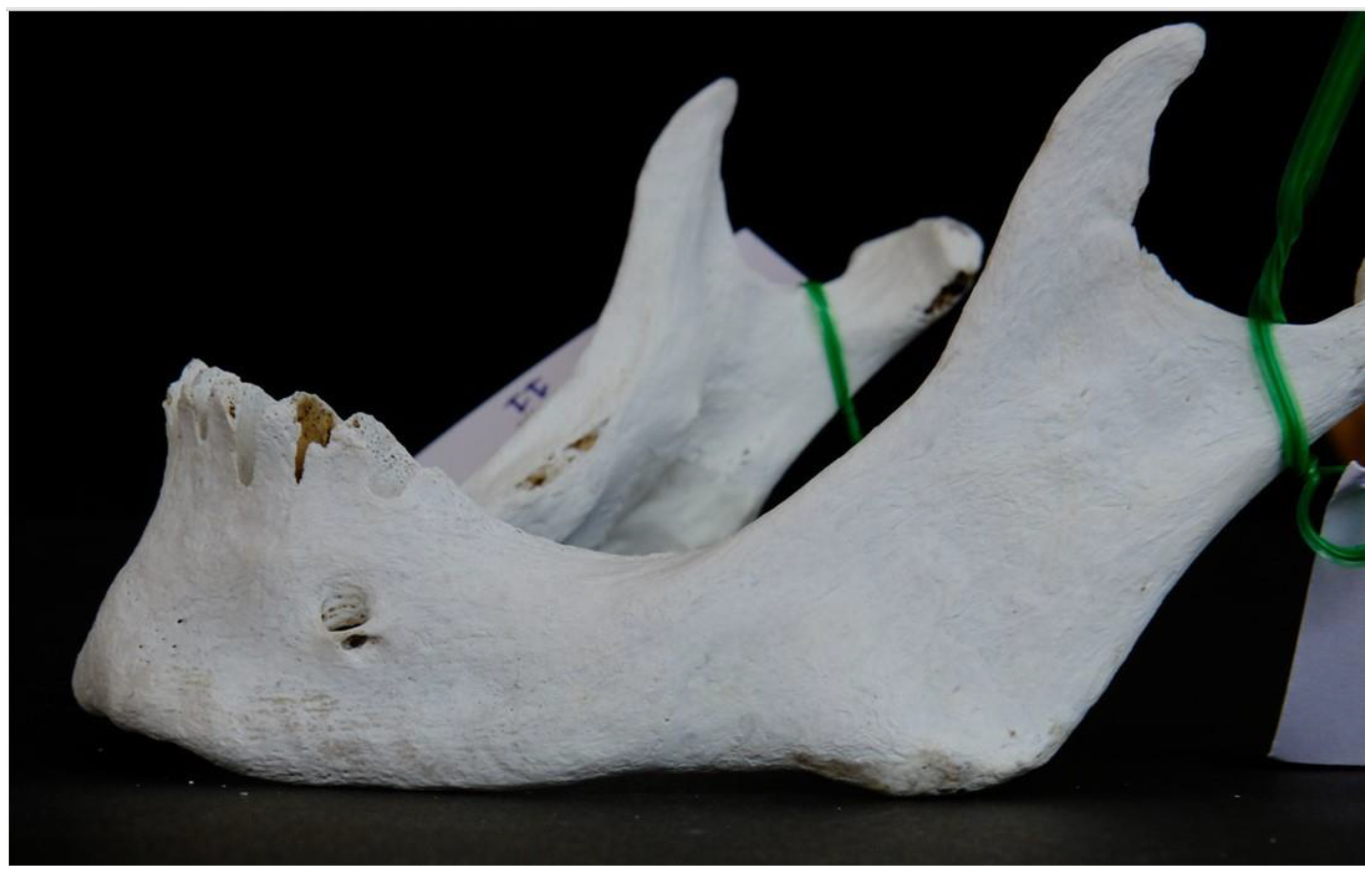 Dentistry 13 00094 g007