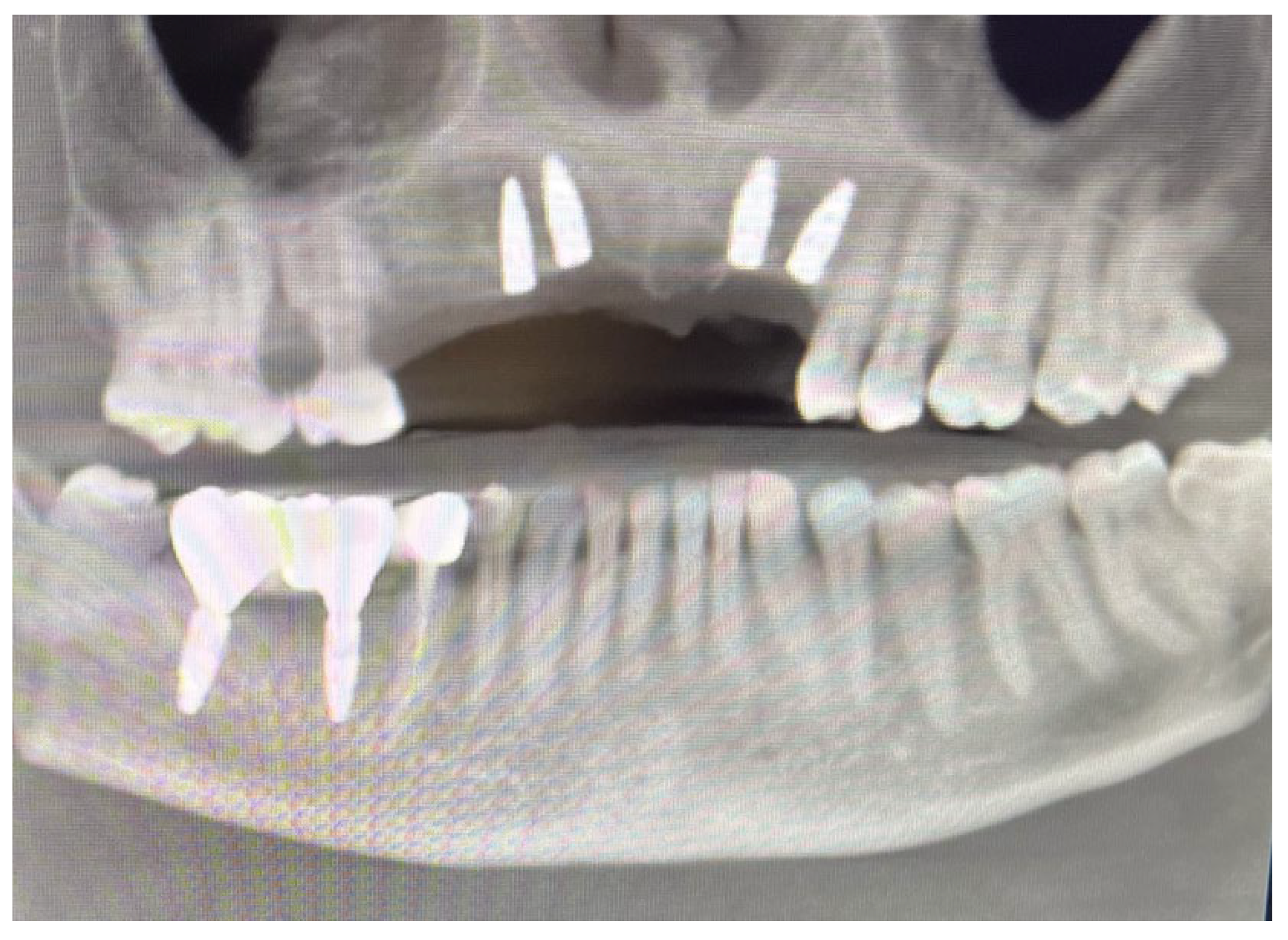 Dentistry 13 00128 g007