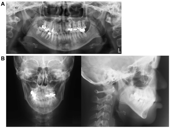 Dentistry 13 00131 g002