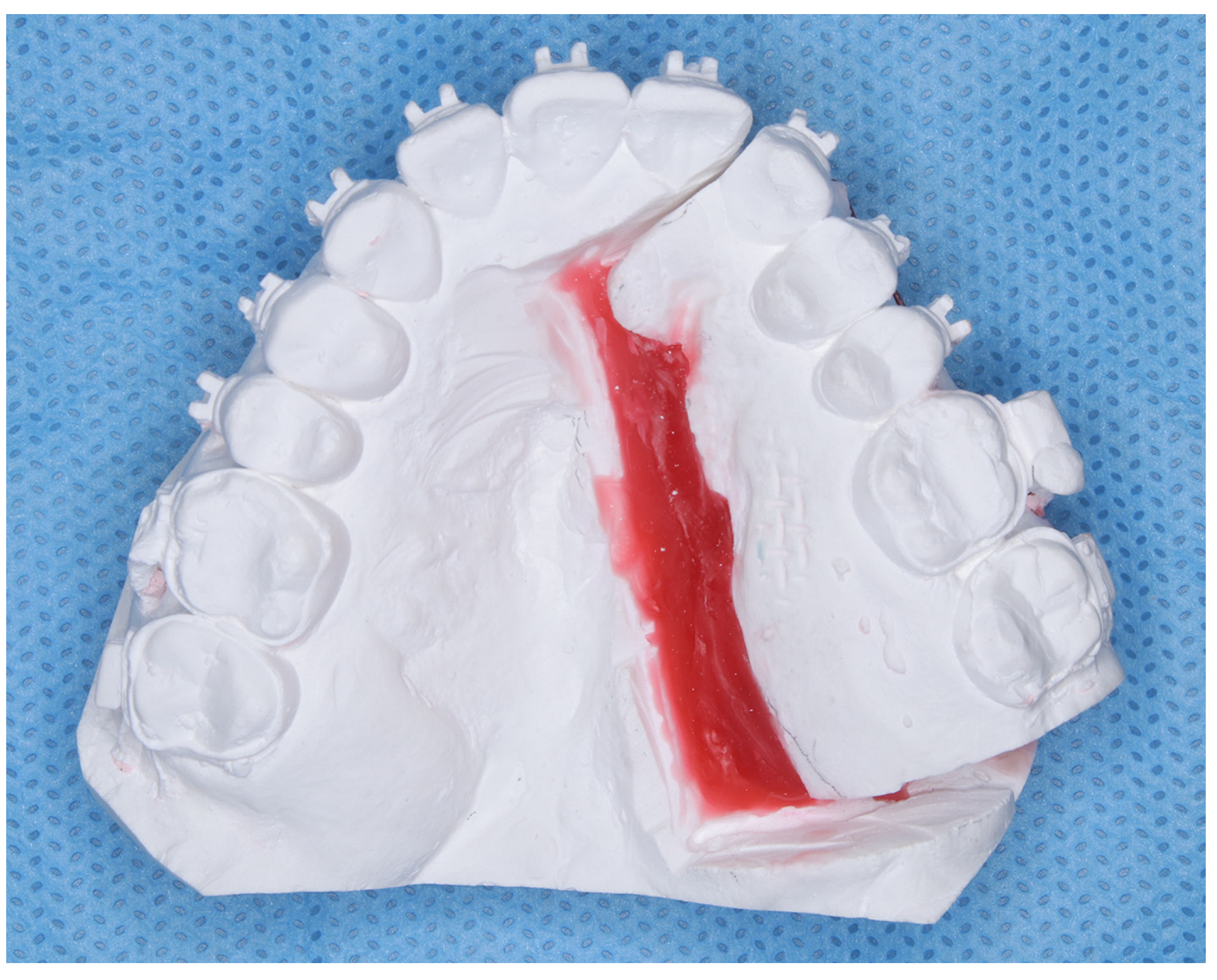 Dentistry 13 00131 g003