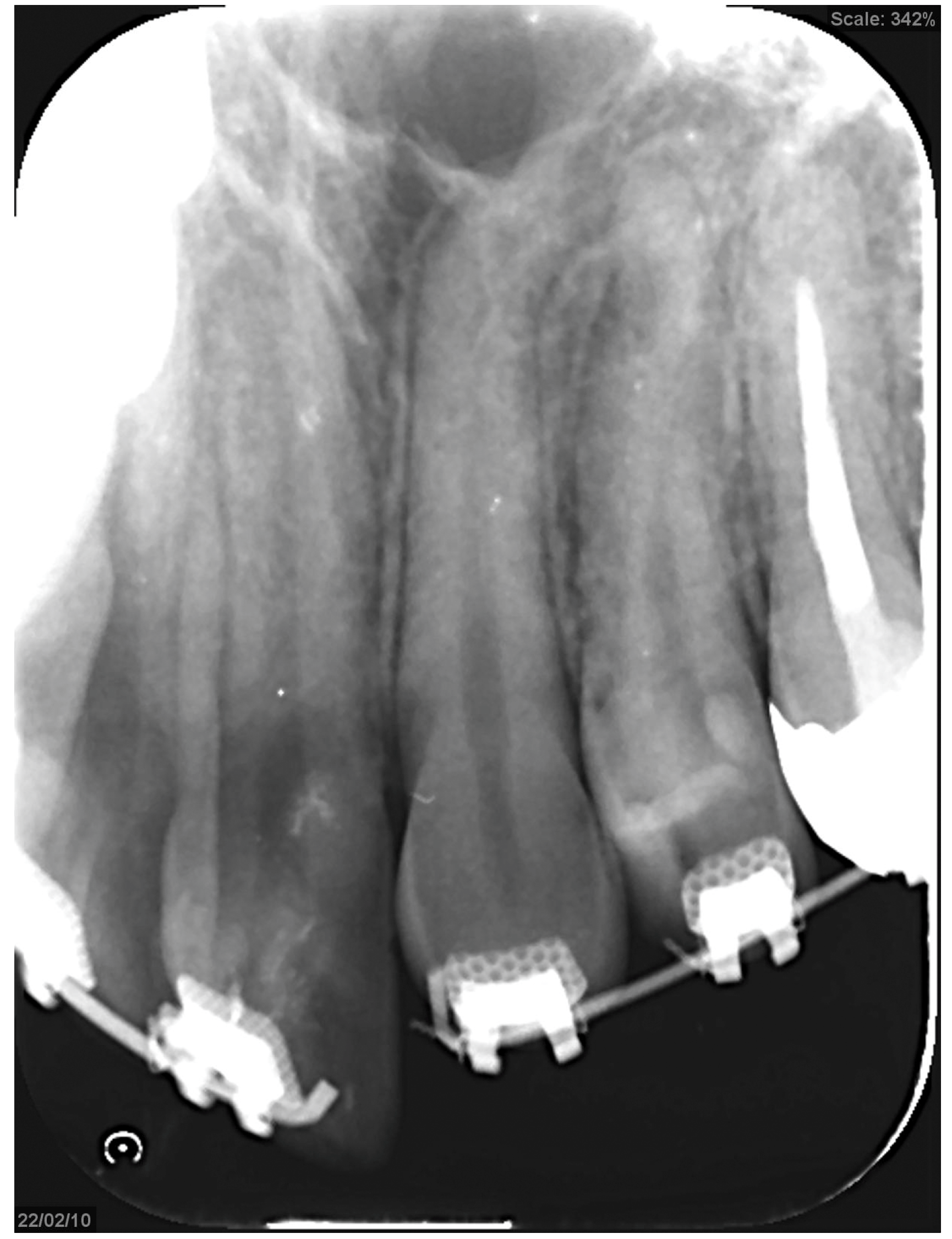 Dentistry 13 00131 g006