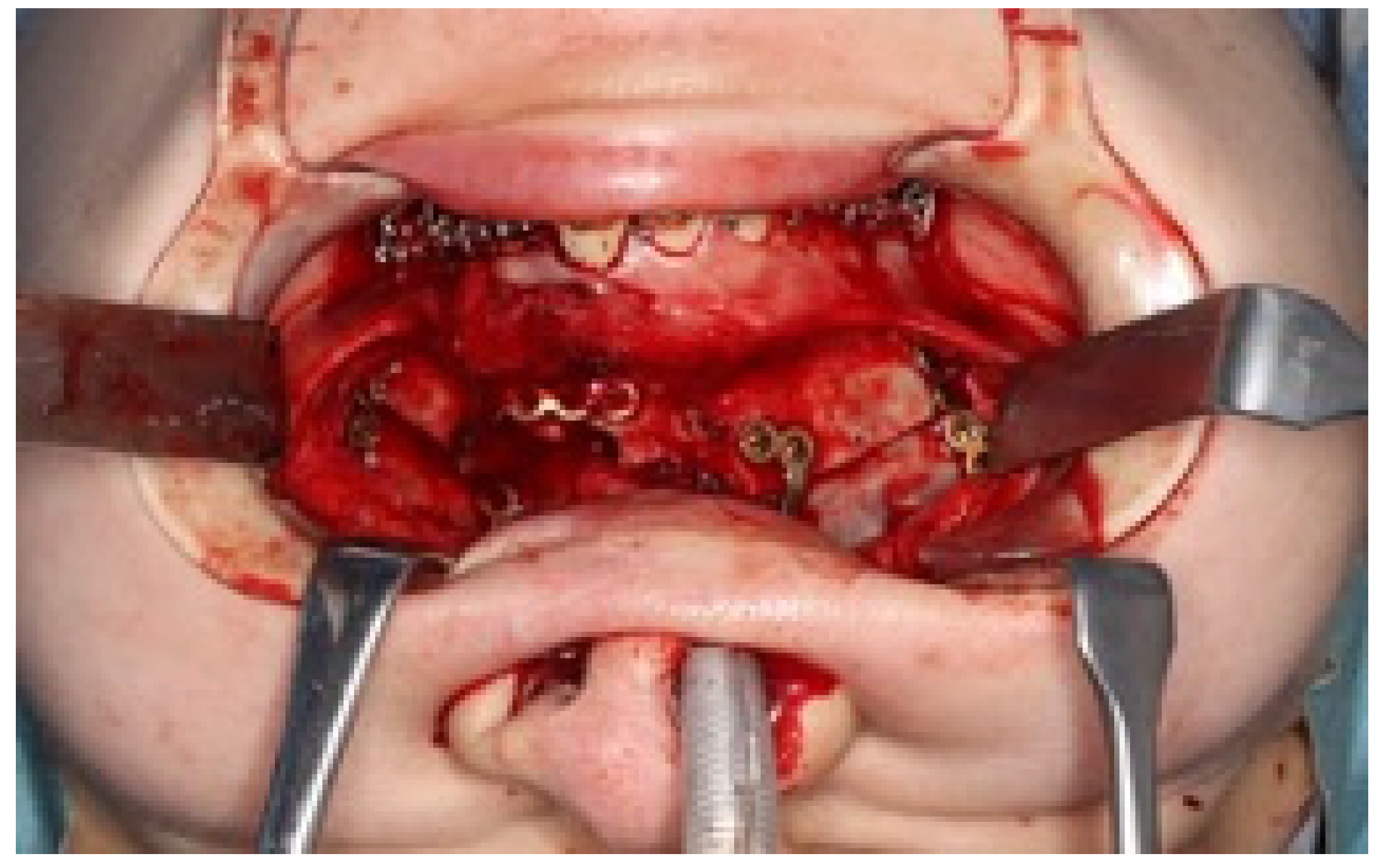 Dentistry 13 00131 g008