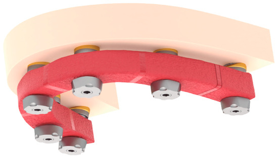 Dentistry 13 00134 g004