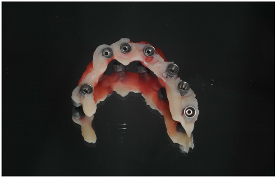 Dentistry 13 00134 g007