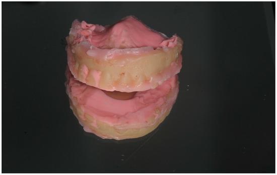 Dentistry 13 00134 g008