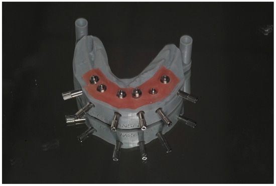 Dentistry 13 00134 g011