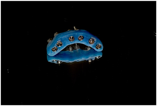 Dentistry 13 00134 g012