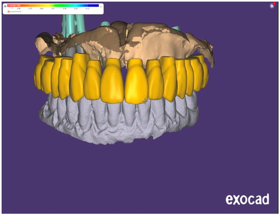 Dentistry 13 00134 g013
