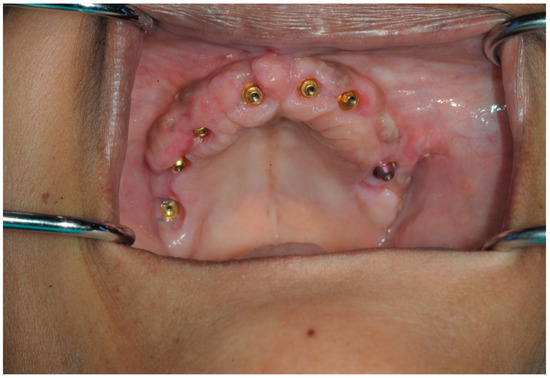 Dentistry 13 00134 g014