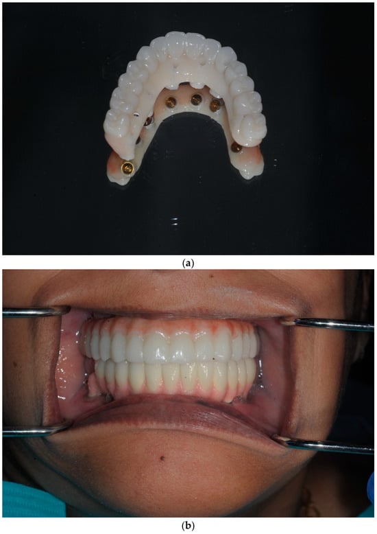 Dentistry 13 00134 g017a