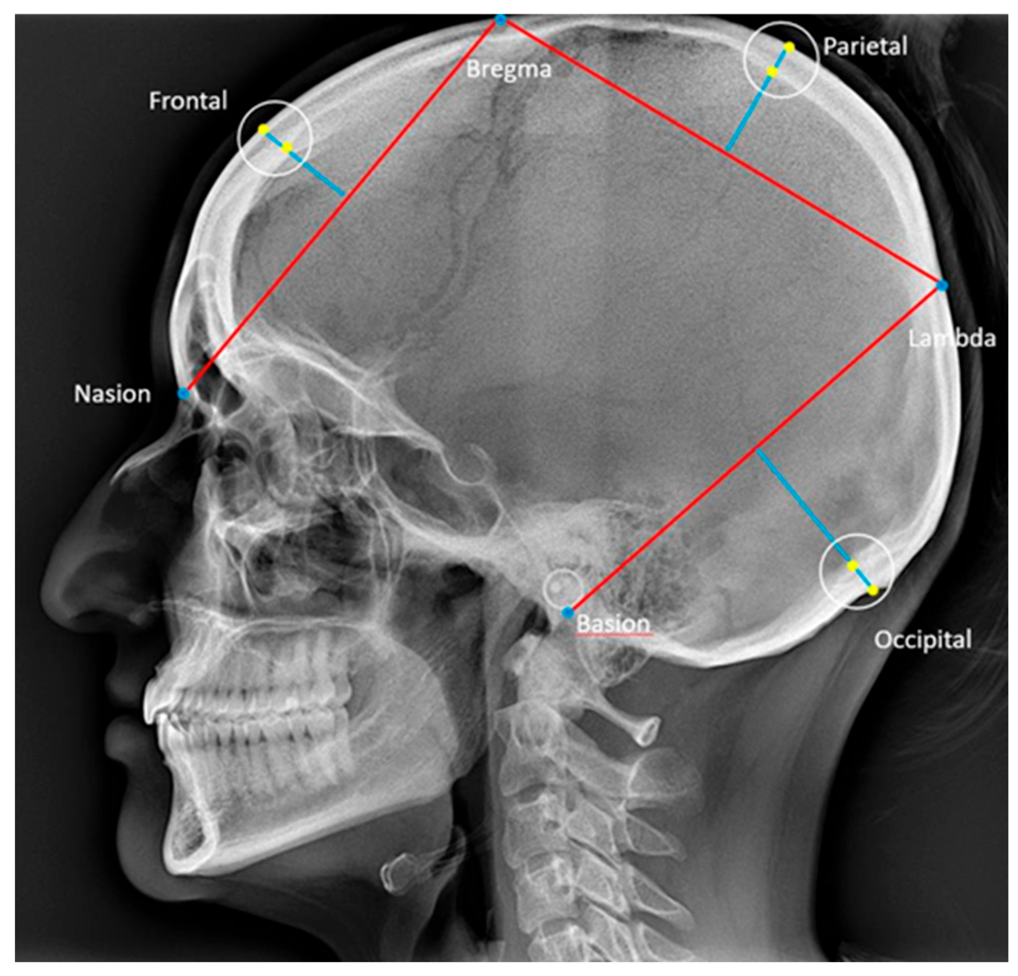 Dentistry 13 00136 g004